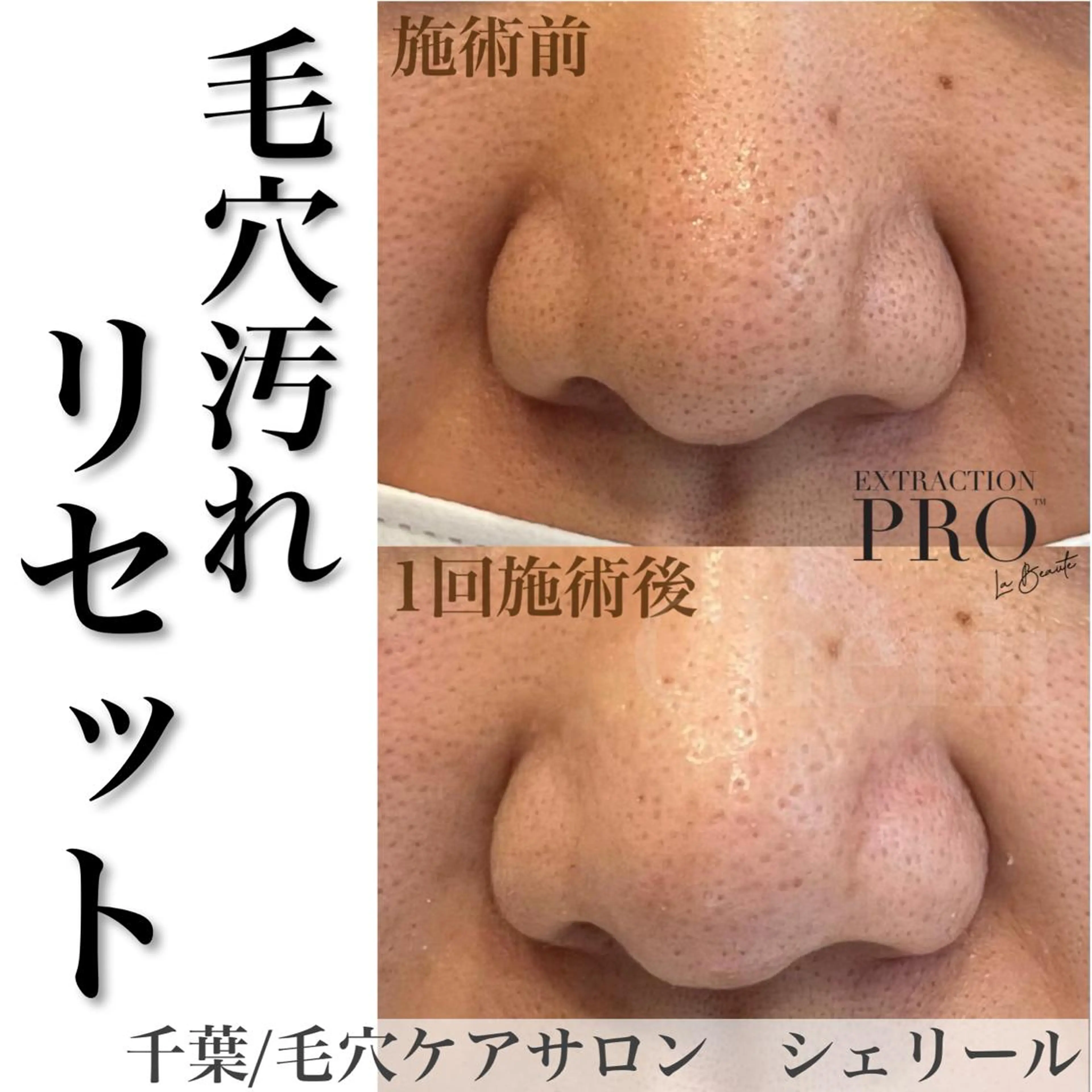 シェリール✳︎ Erinaのマツエク・マツパデザイン