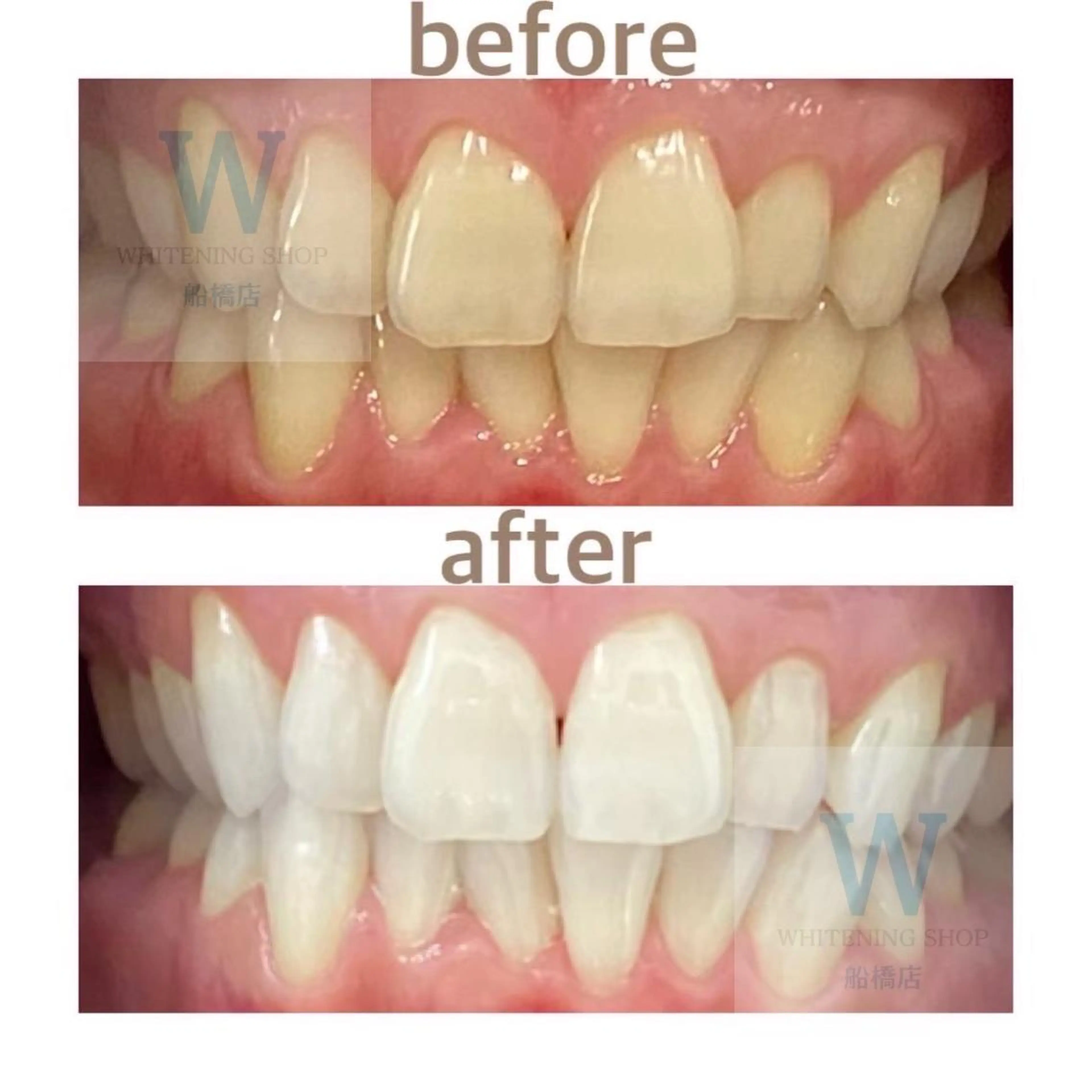 エステ リラク ホワイトニング ショップ船橋店のエステ・リラクイメージ