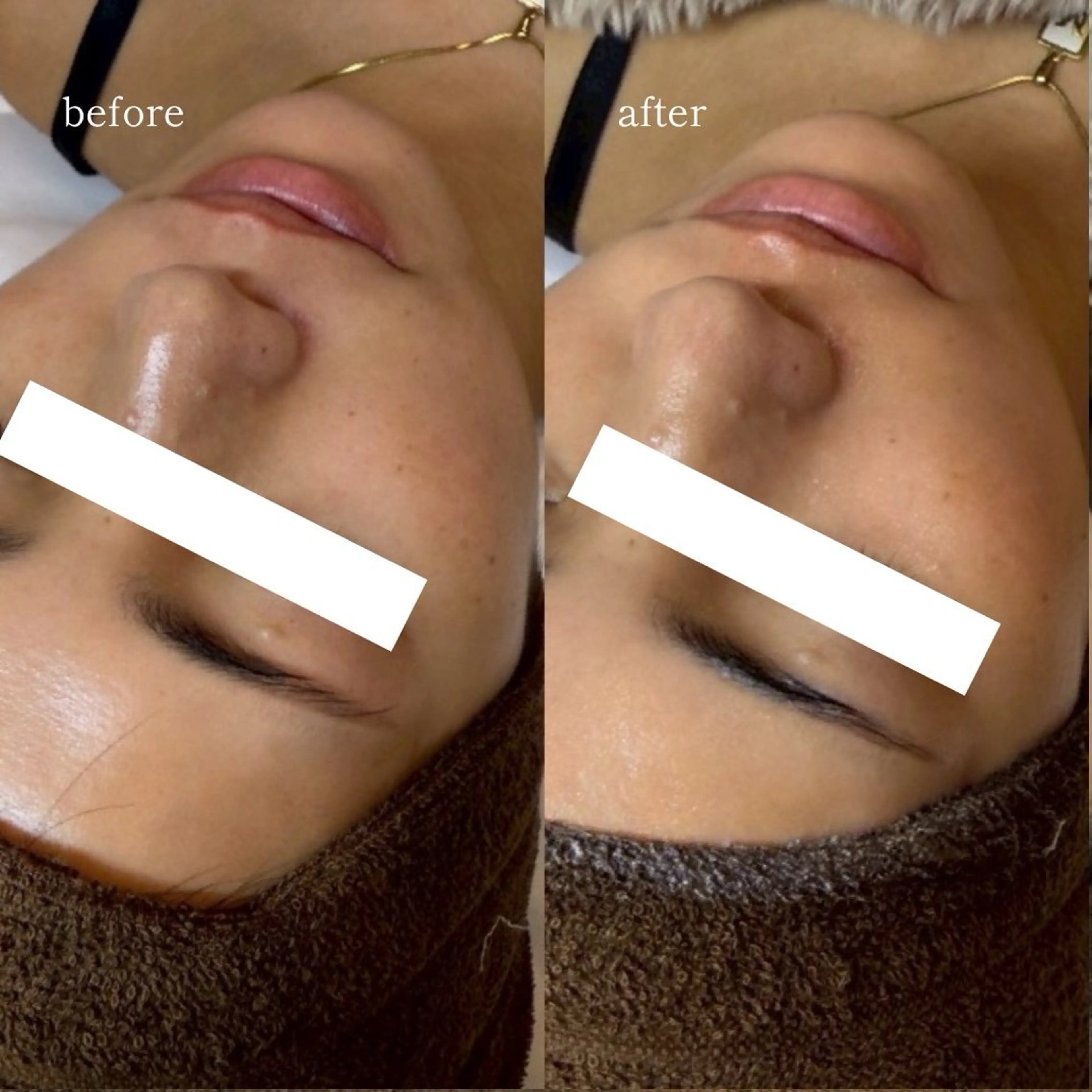 エステ EARNEST大阪 心斎橋【韓国肌管理】のエステ・リラクイメージ