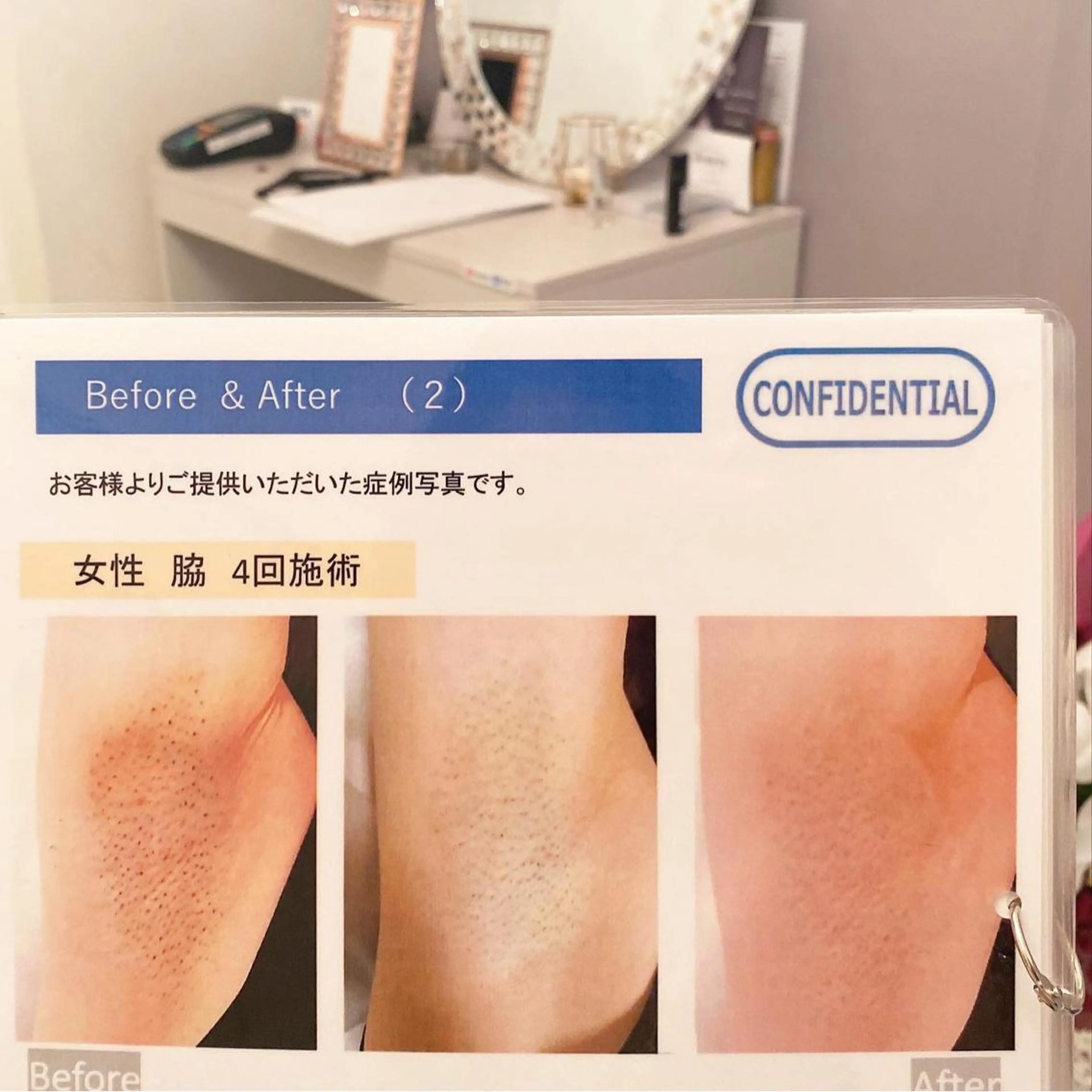 💎Jemery 脱毛まつエクサロン💎所属・Jemery関内/ 眉毛/まつ毛/脱毛の眉毛・アイブロウイメージ