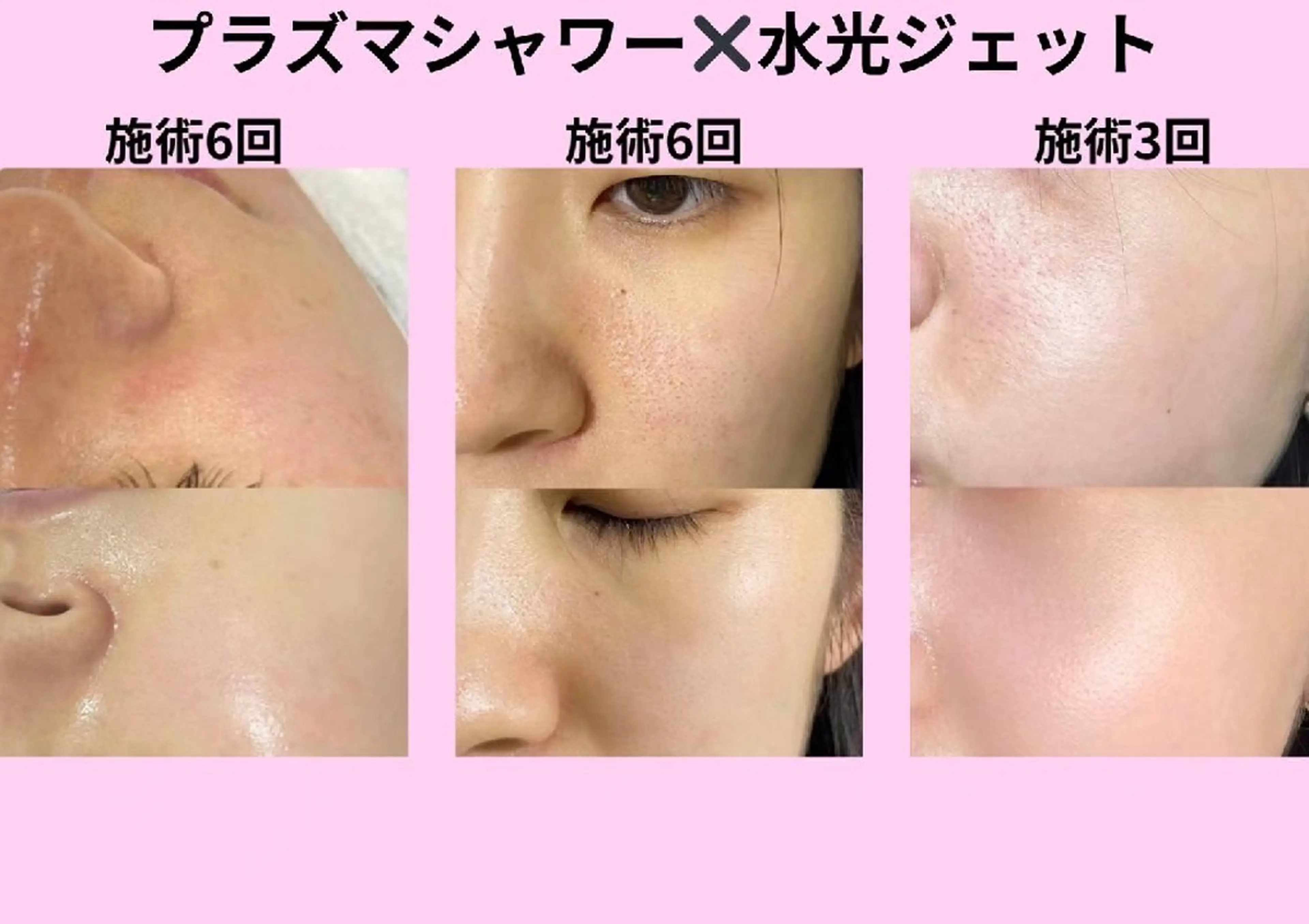 マツエク・マツパ 結婚式・ブライダル aliaハイフ&水光ジェットサロン所属・aliaハーブ水光店 エステティシャン募集のエステ・リラクイメージ