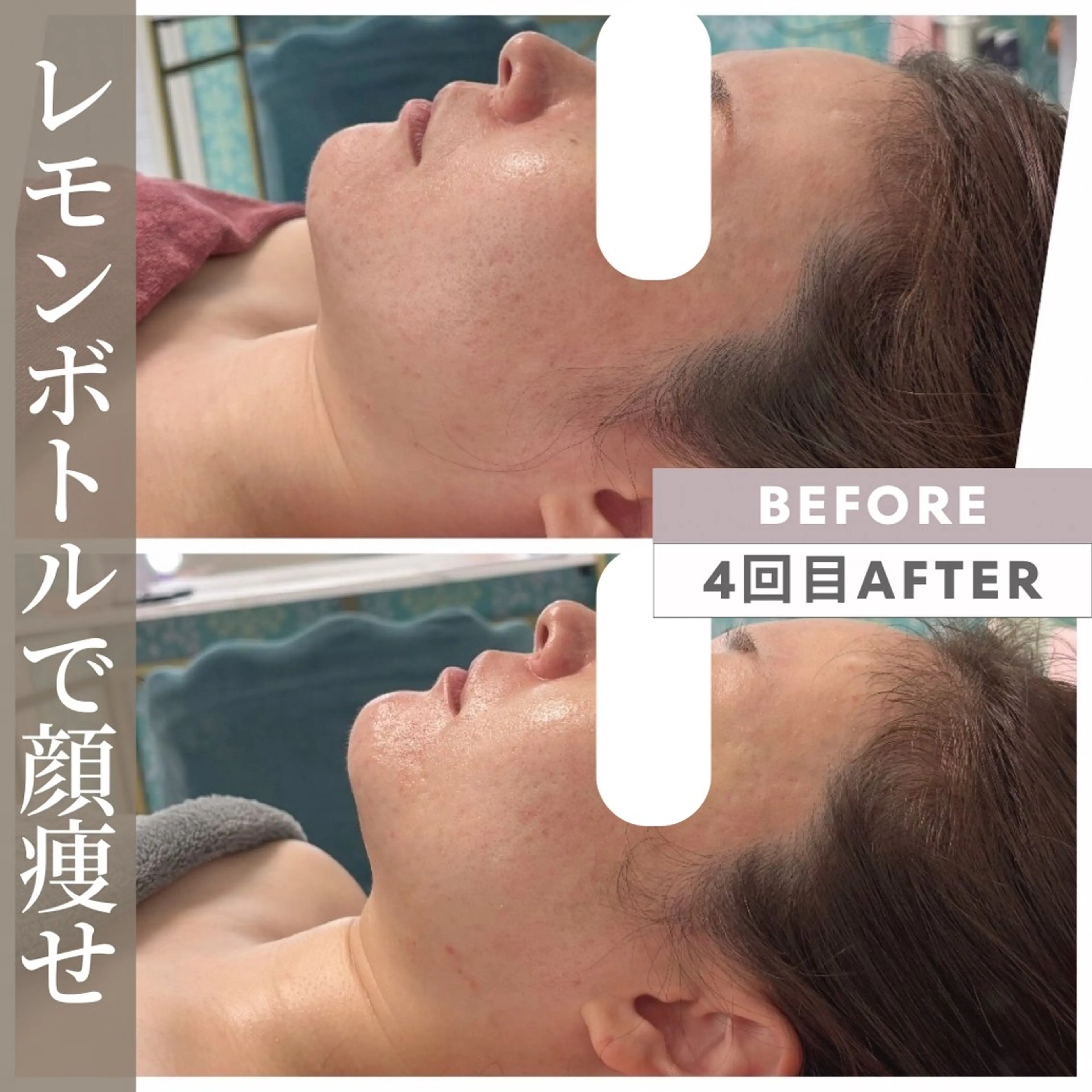 エステ リラク 小顔矯正専門店 【RED】池田のエステ・リラクイメージ