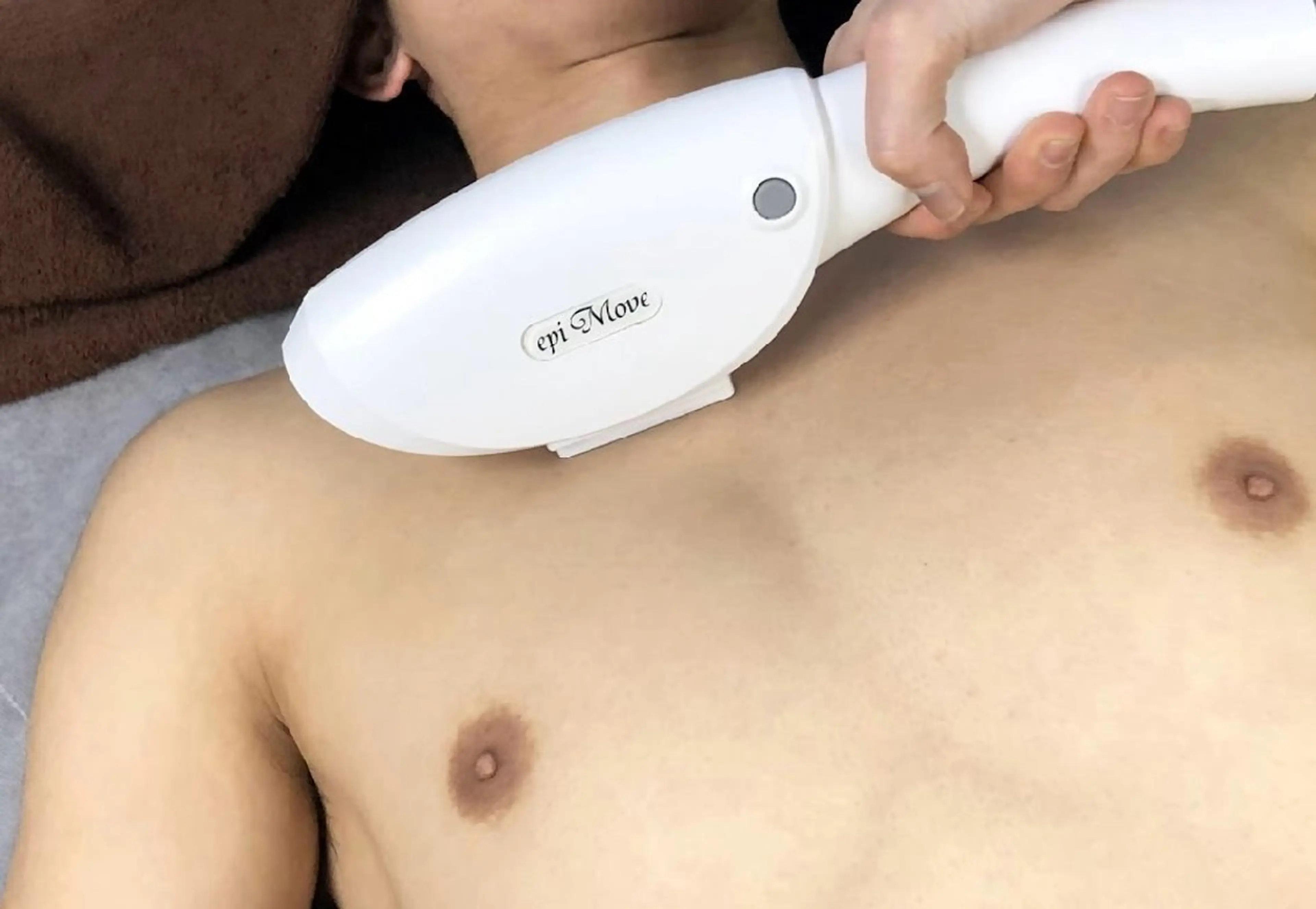♪2回目以降♪全身光脱毛(顔・VIO除く)(男性)の写真