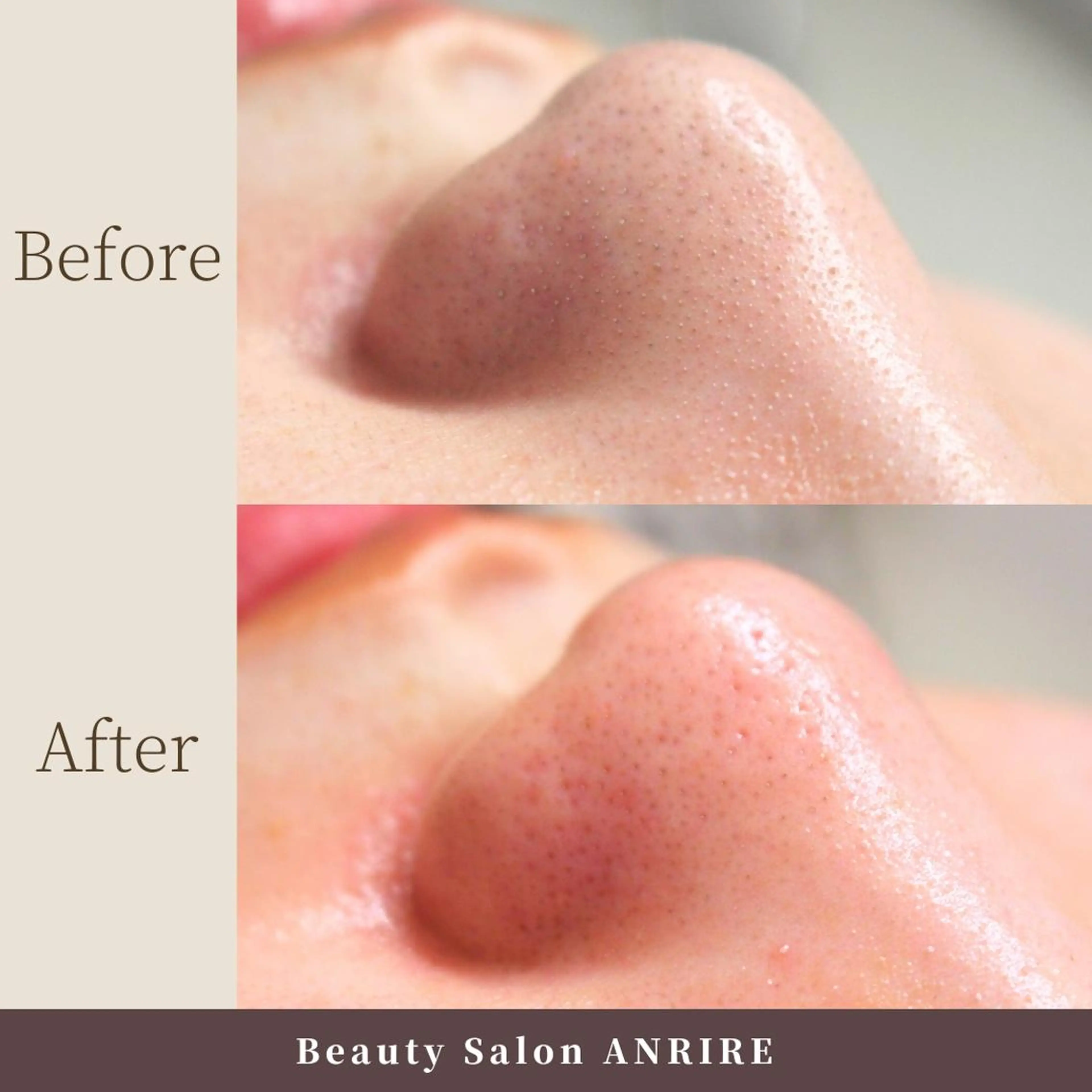 エステ ANRIRE (アンリール)のエステ・リラクイメージ