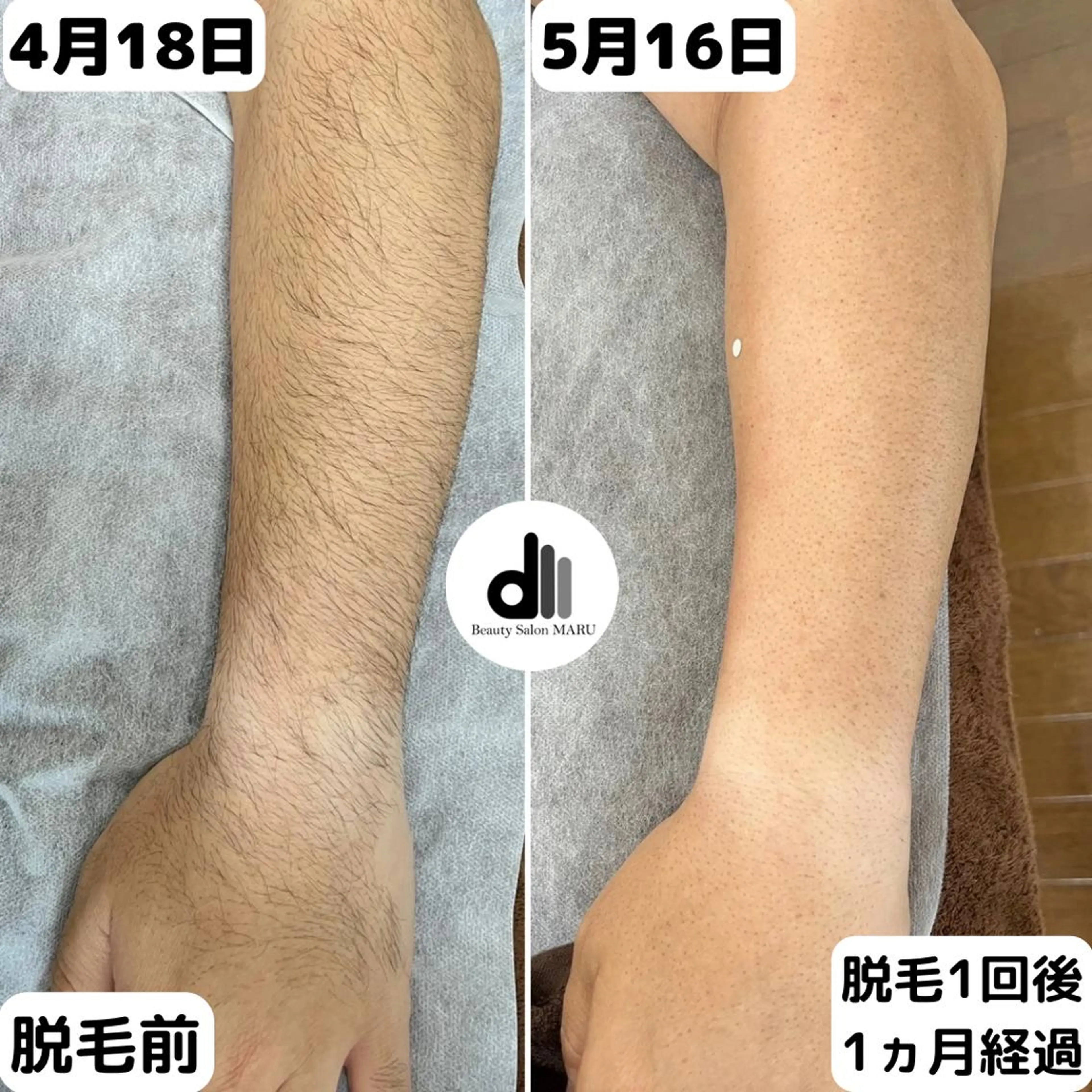 メンズ Beauty Salon MARU所属・新潟市メンズ【脱毛】 MARUのエステ・リラクイメージ