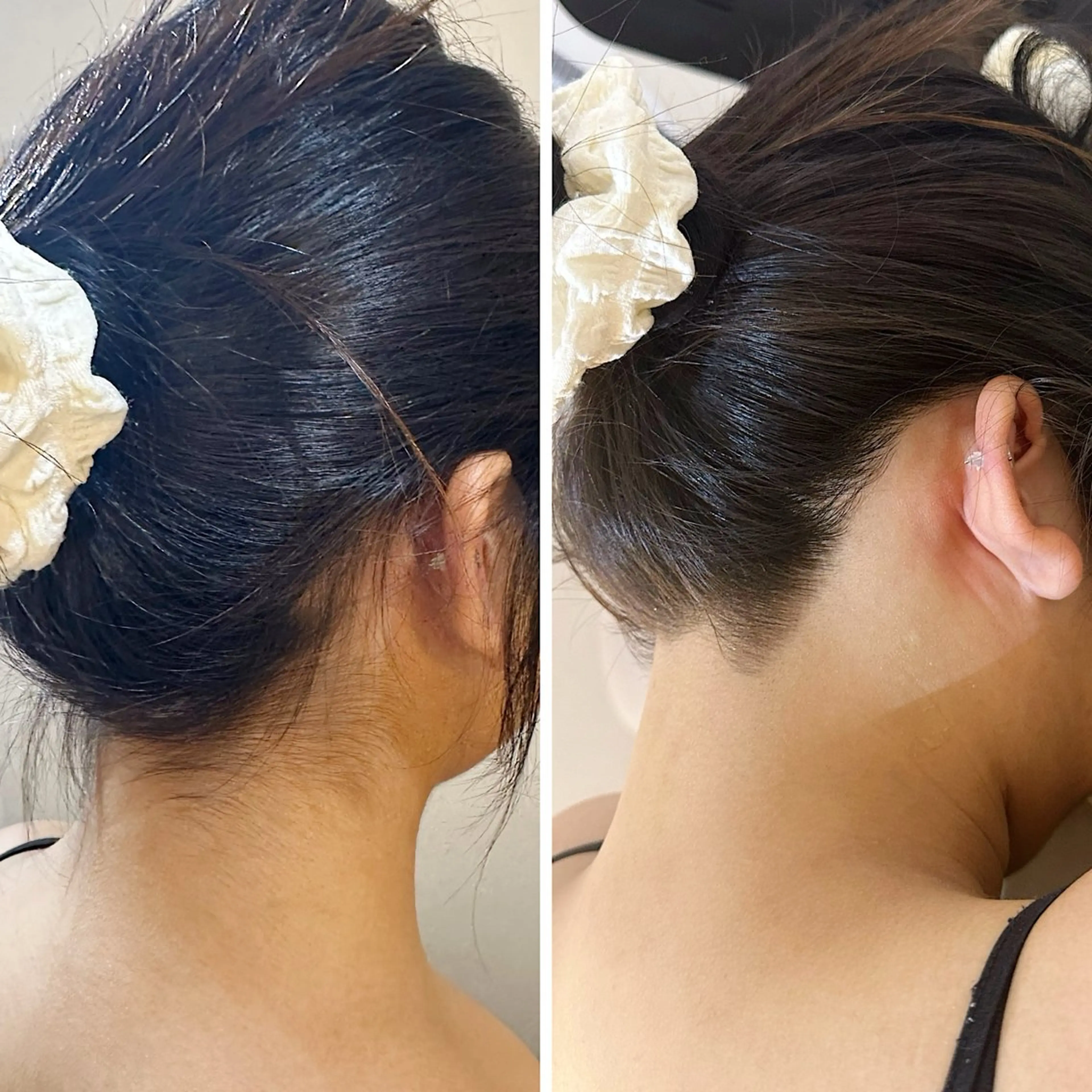 脱毛 うなじ脱毛/美肌脱毛 LABELのエステ・リラクイメージ