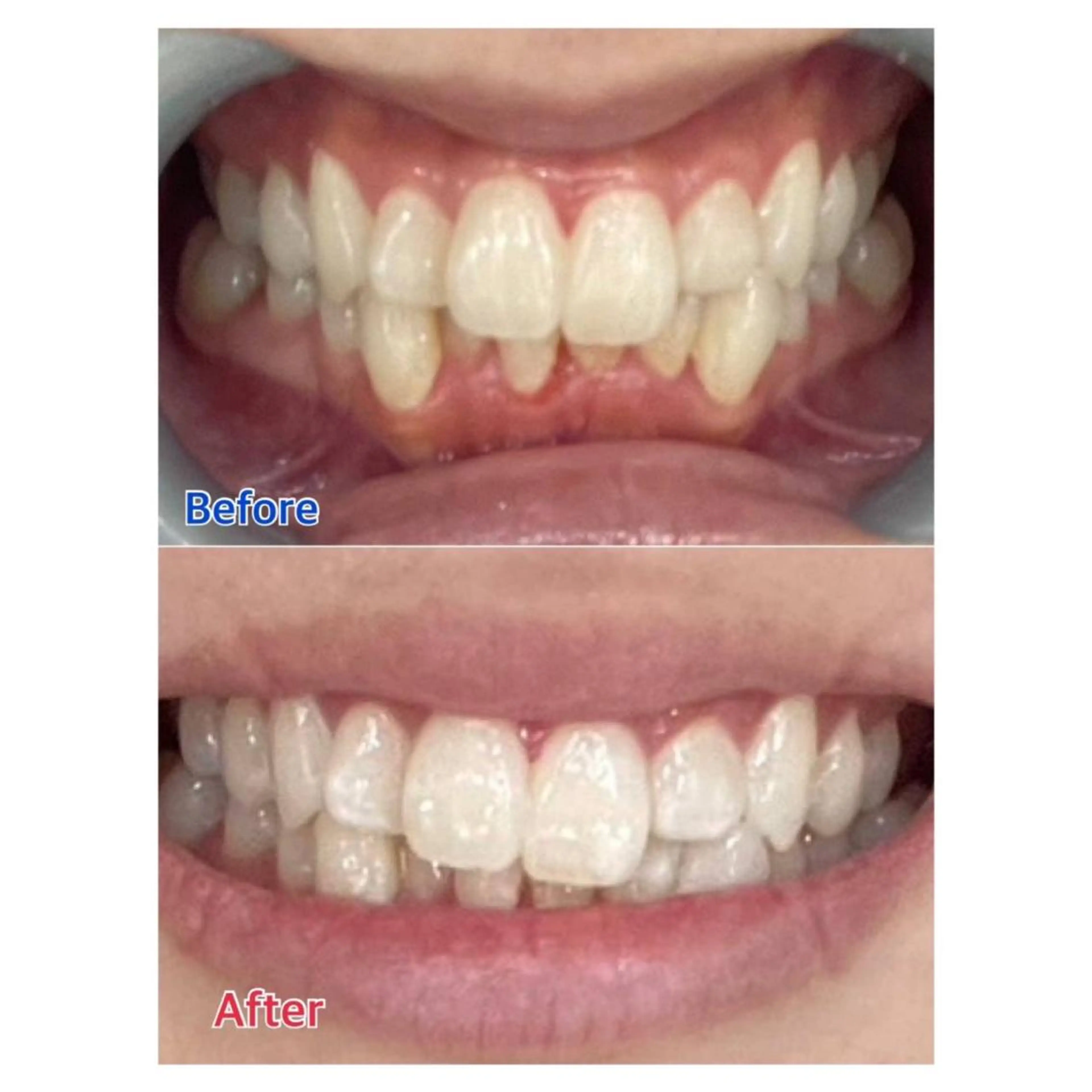 MBEAUTYSALON 千葉店・京成大久保所属・Melty 輝のその他イメージ