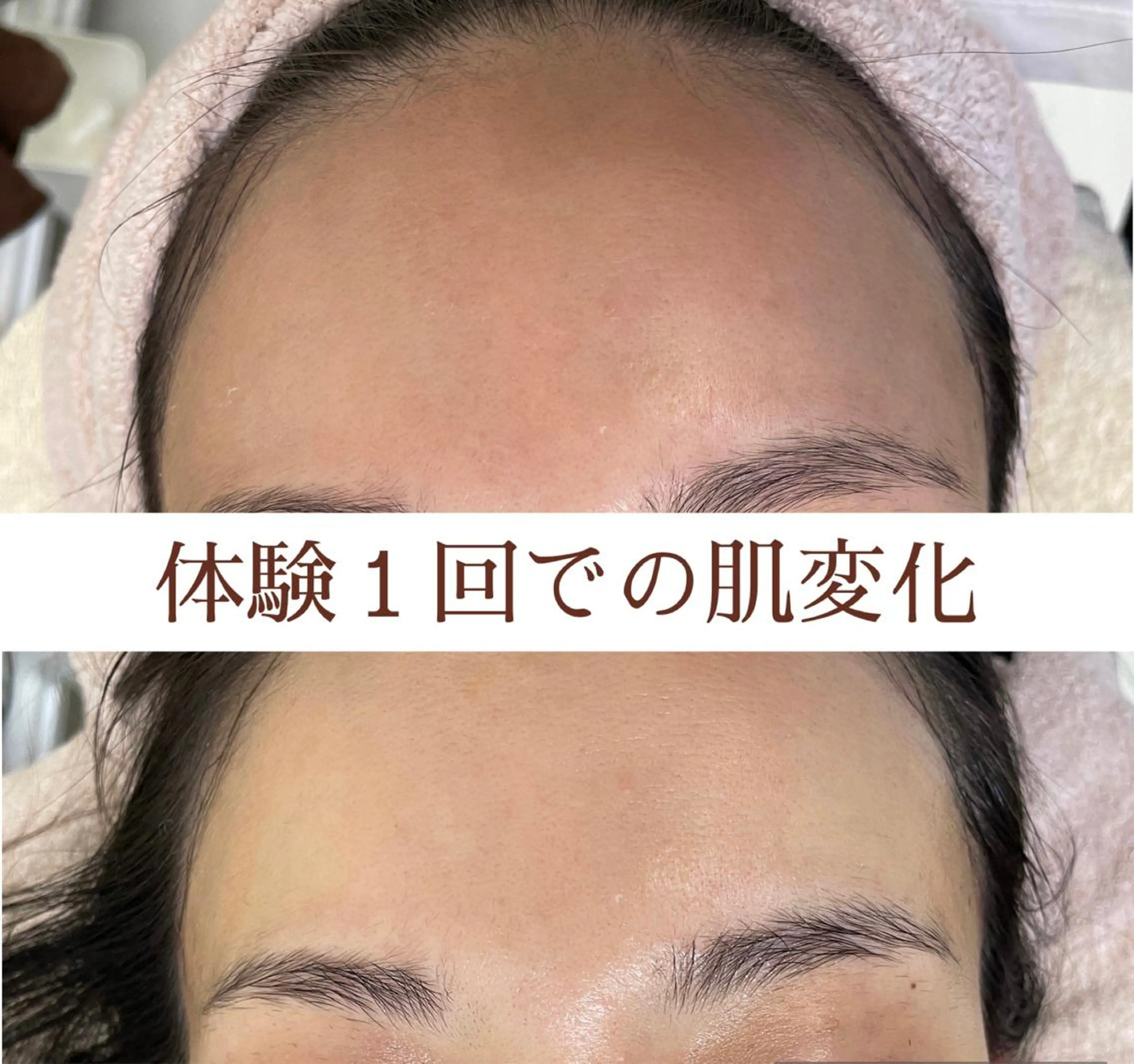 エステ 都度払い 肌質改善専門サロンのエステ・リラクイメージ