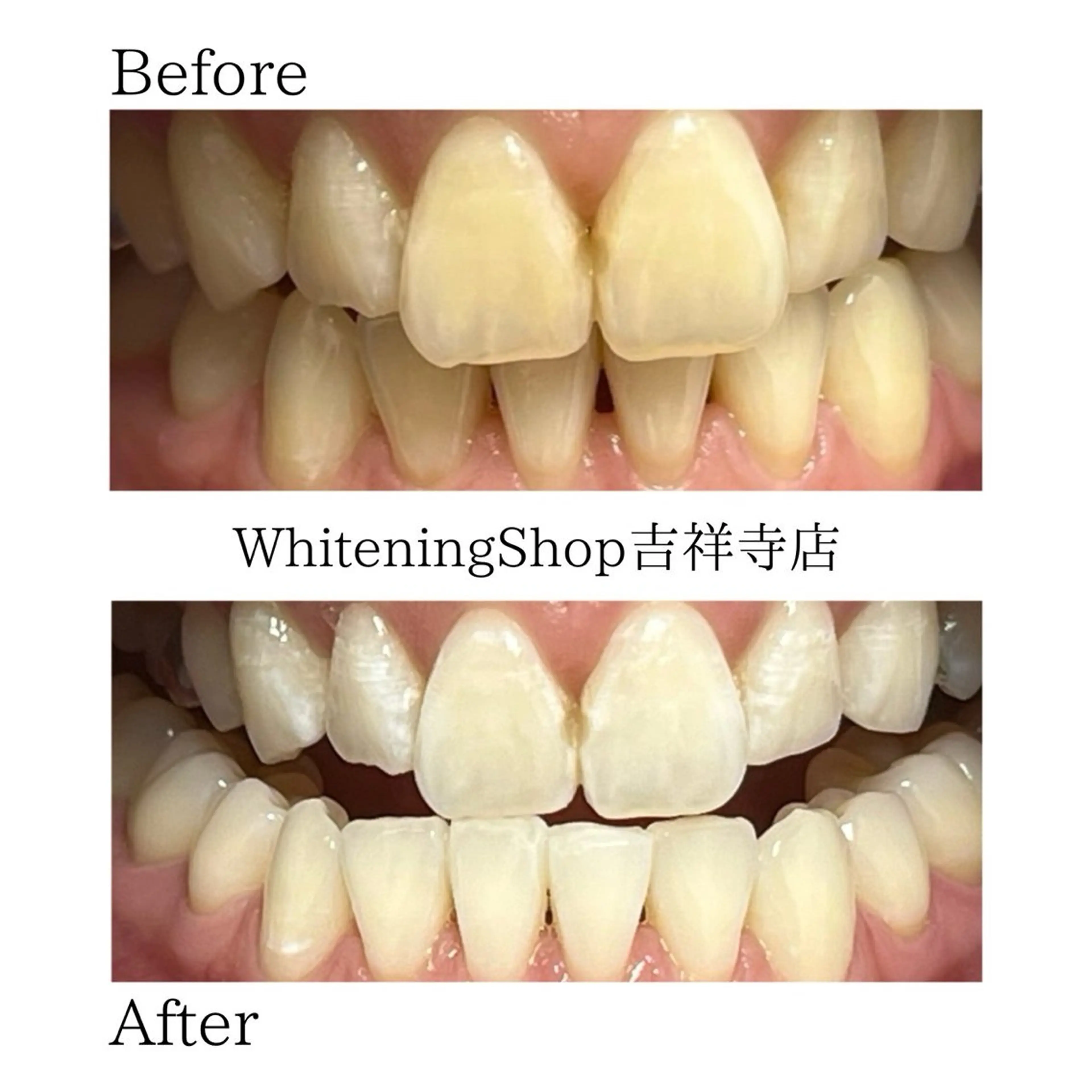 エステ リラク ホワイトニング ショップ吉祥寺店のエステ・リラクイメージ