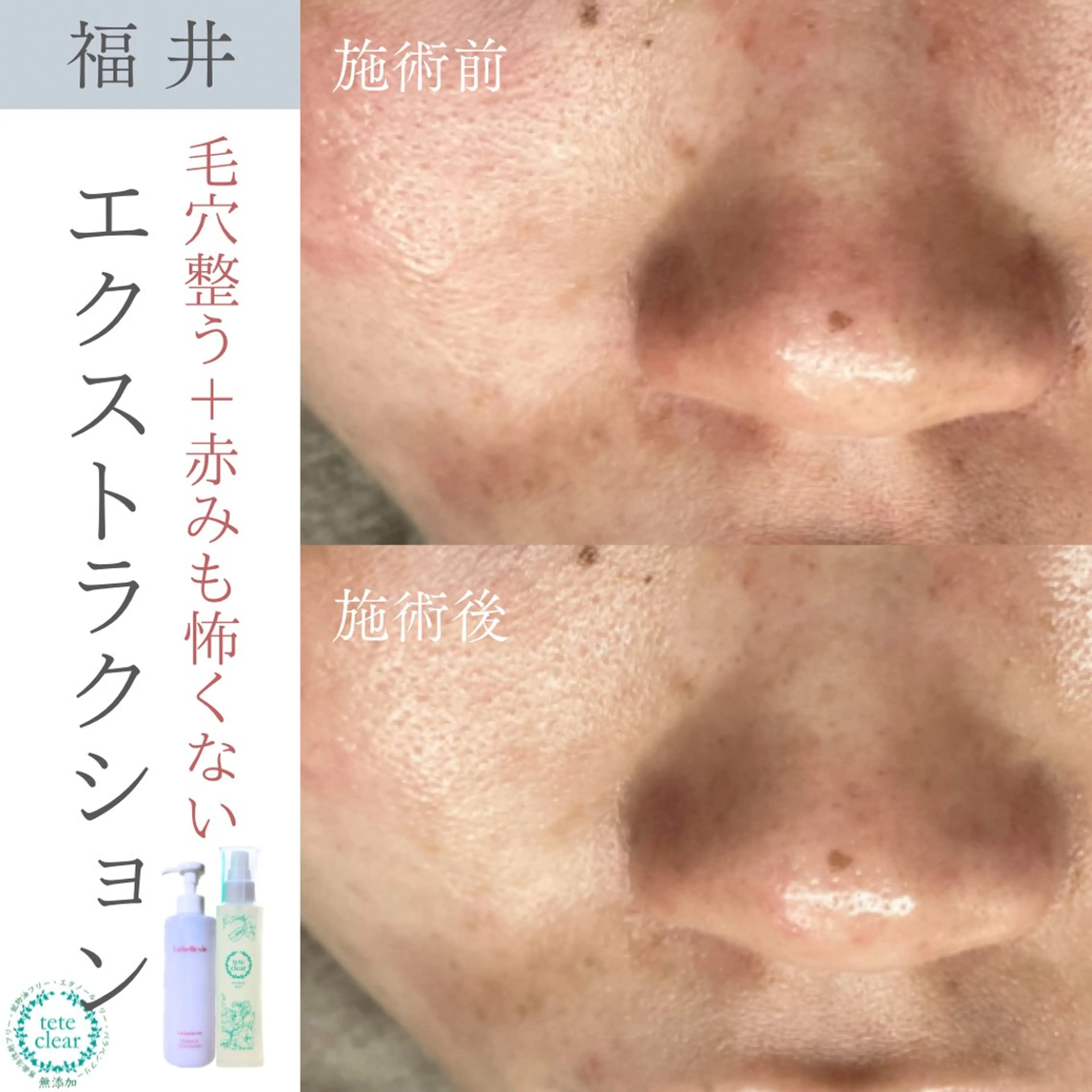 毛穴ケア専門サロン Yourmeユアミーのエステ・リラクイメージ