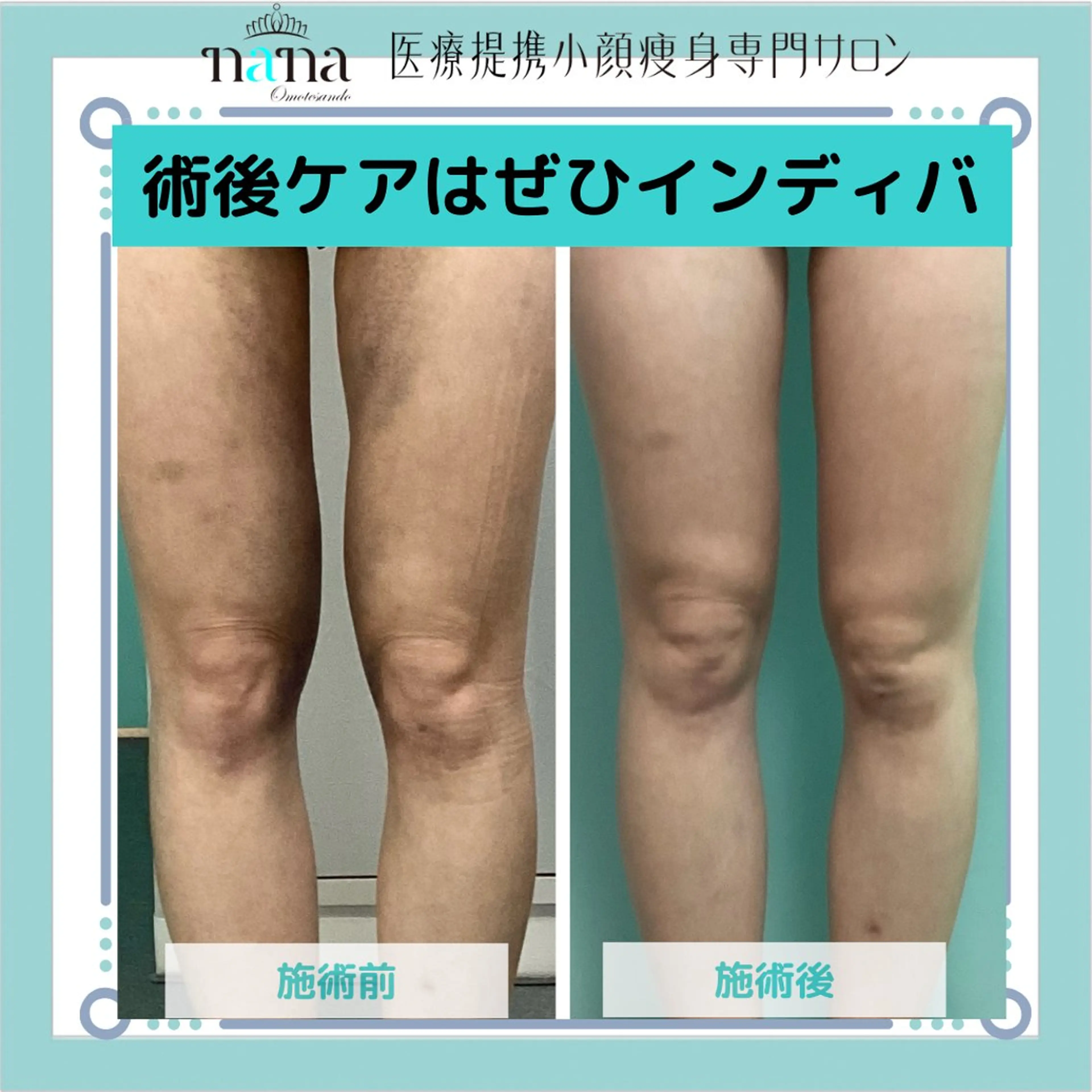 エステ リラク 小顔痩身インディバ Nana表参道のエステ・リラクイメージ