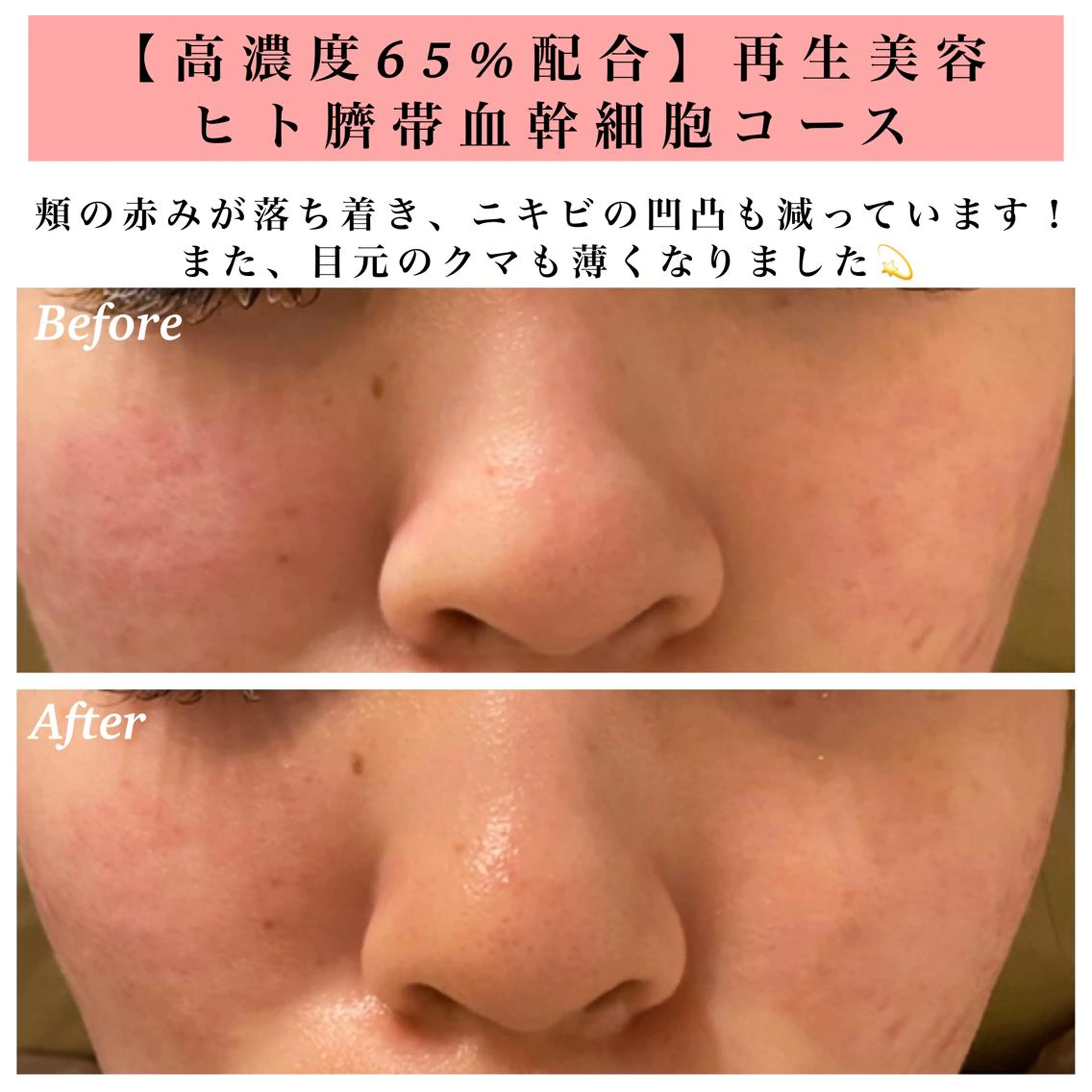 エステ リラク Bellesthe （ベルエステ）のエステ・リラクイメージ