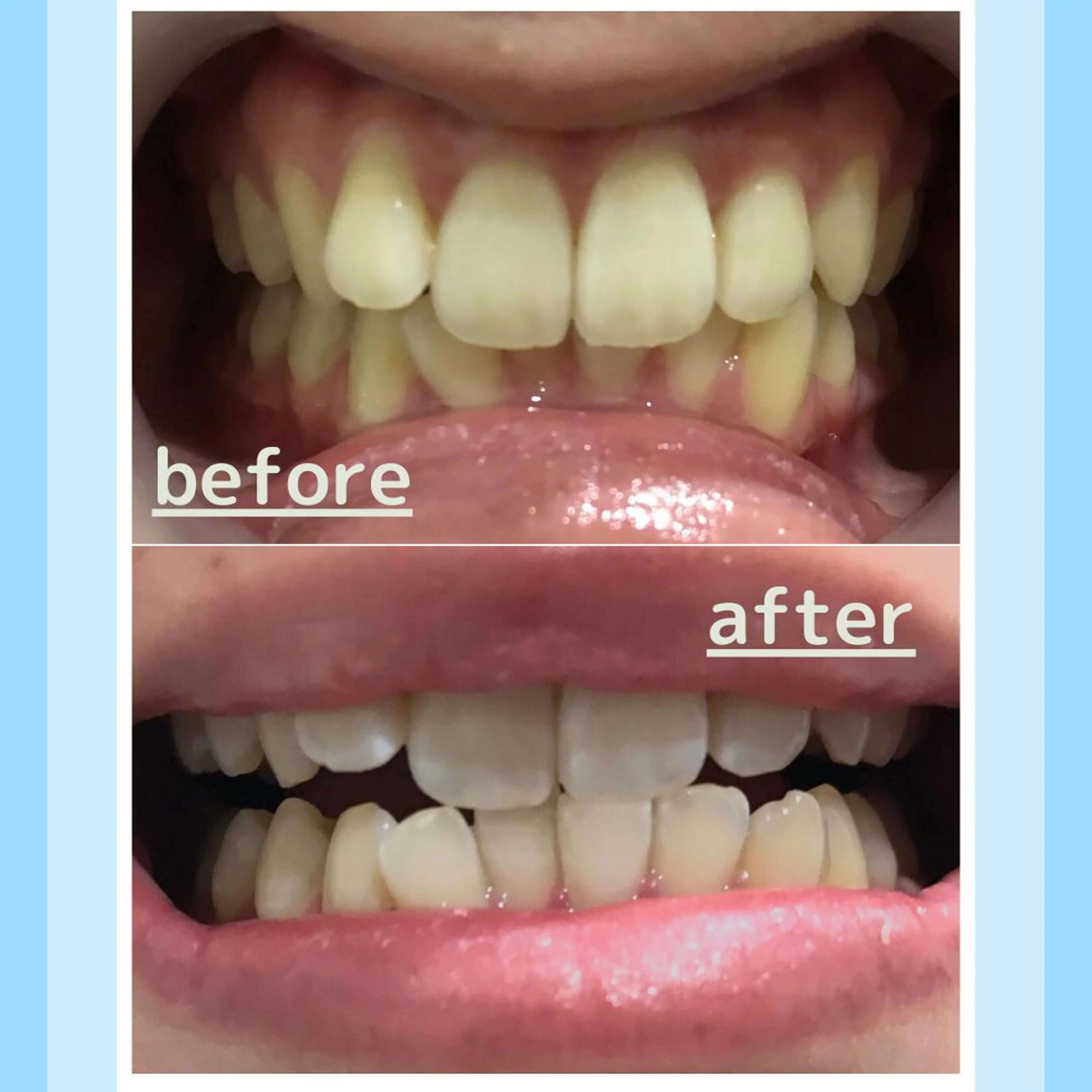 メンズ その他 お手軽ホワイトニングsalon mina所属・武元 奈津美のその他イメージ