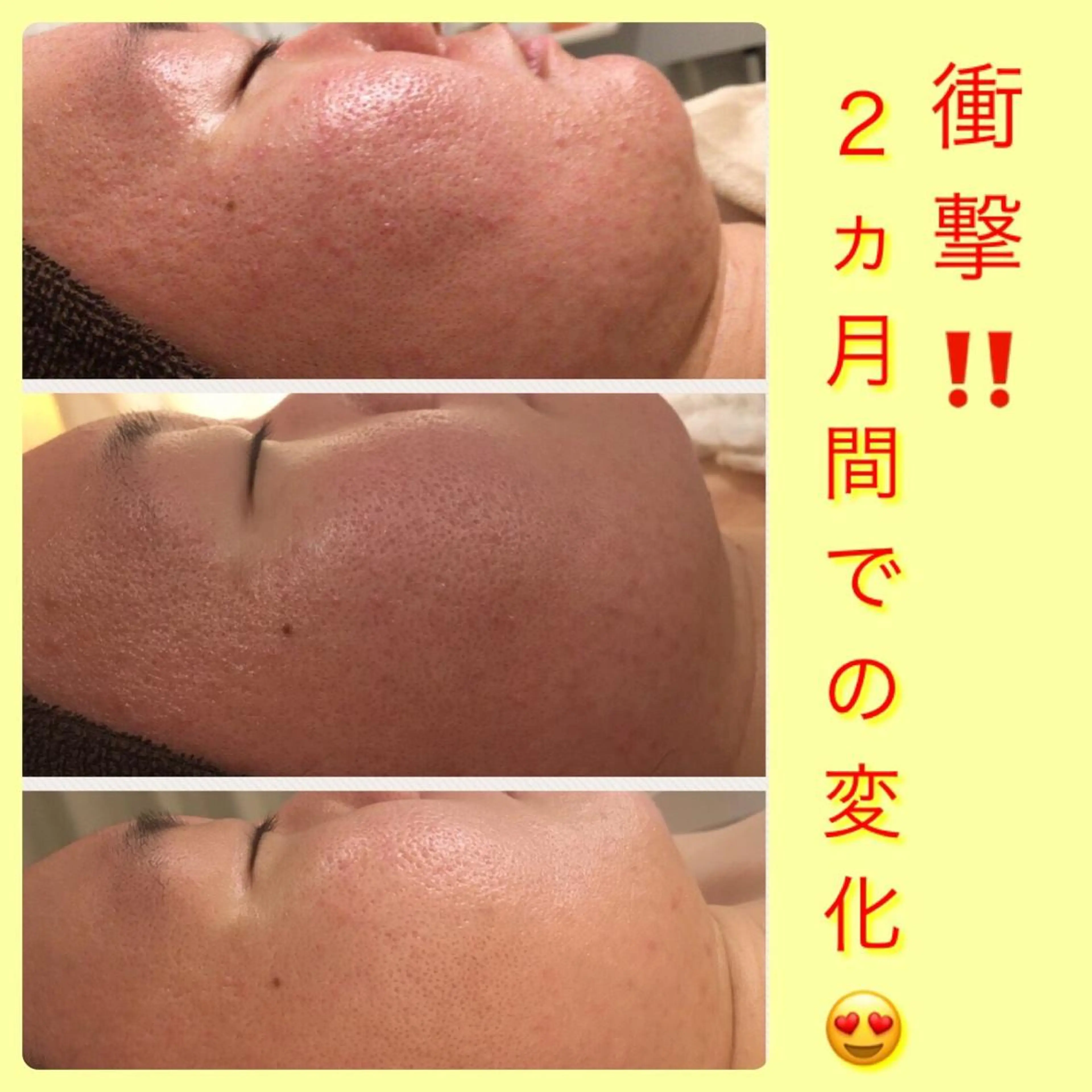 ミディアム カラー パーマ ヘアアレンジ メンズ キッズ ネイル マツエク・マツパ アクール　齋藤 ♡肌トラブル卒業のエステ・リラクイメージ