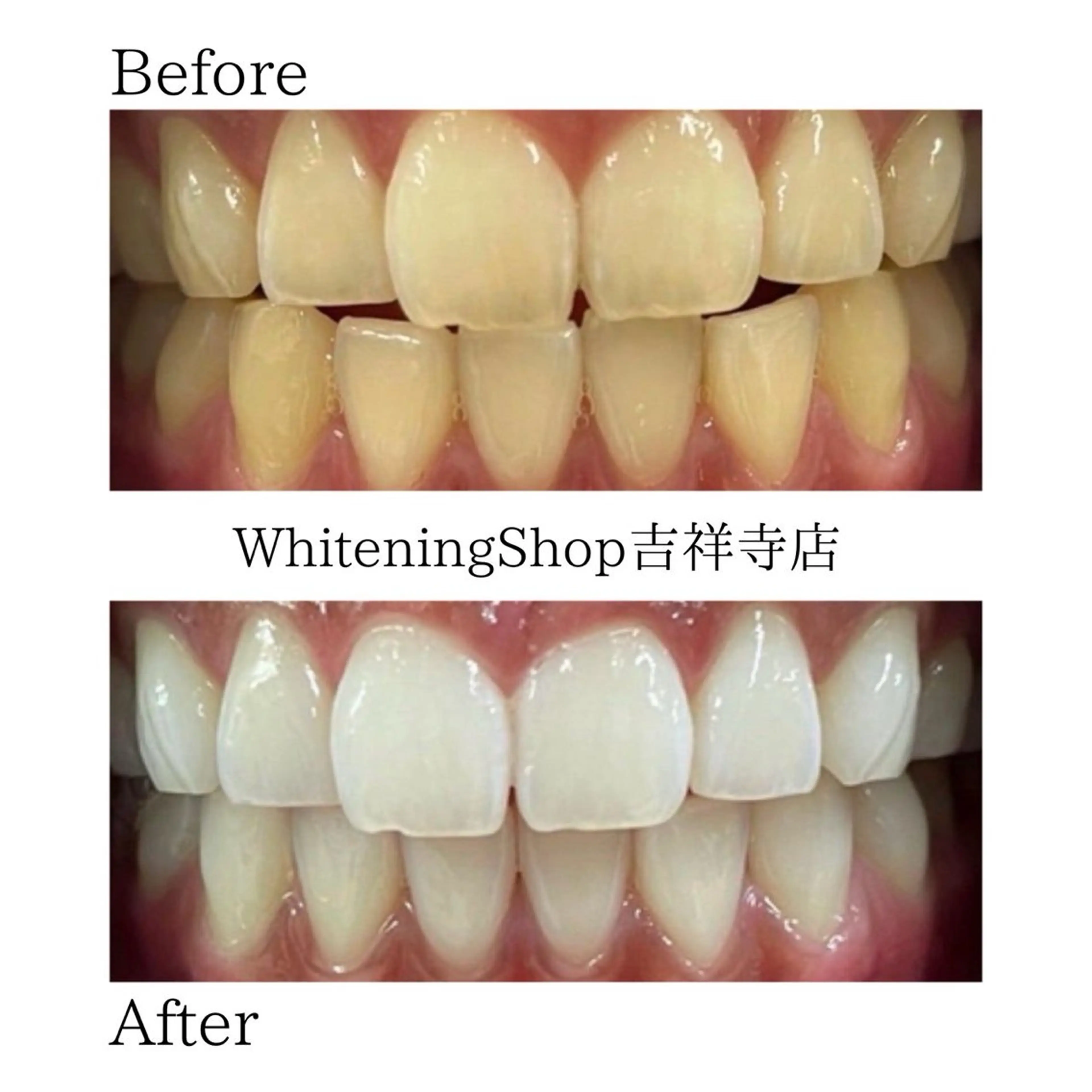 エステ リラク ホワイトニング ショップ吉祥寺店のエステ・リラクイメージ