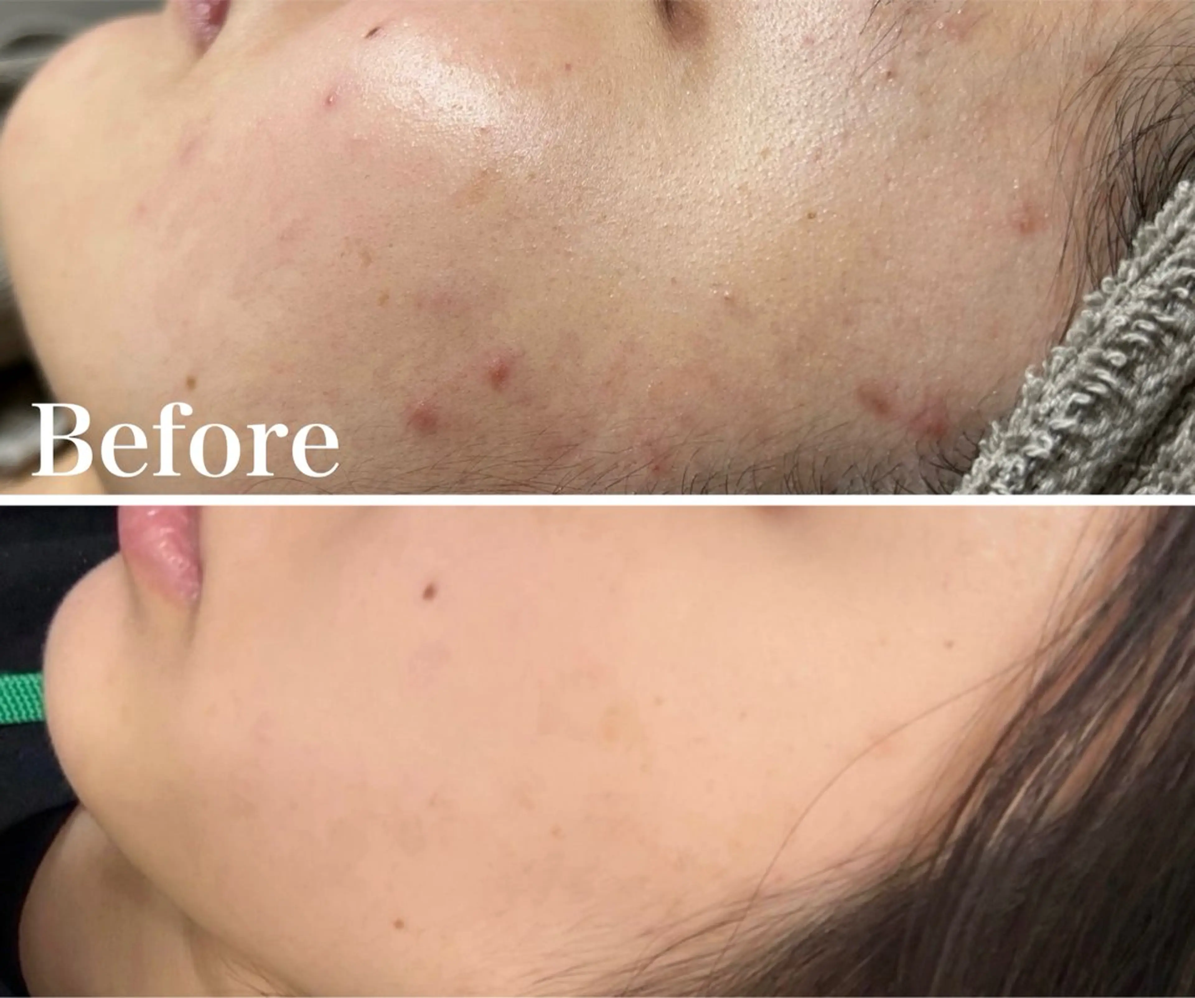 OOPARTS所属・大塚 杏美のエステ・リラクイメージ