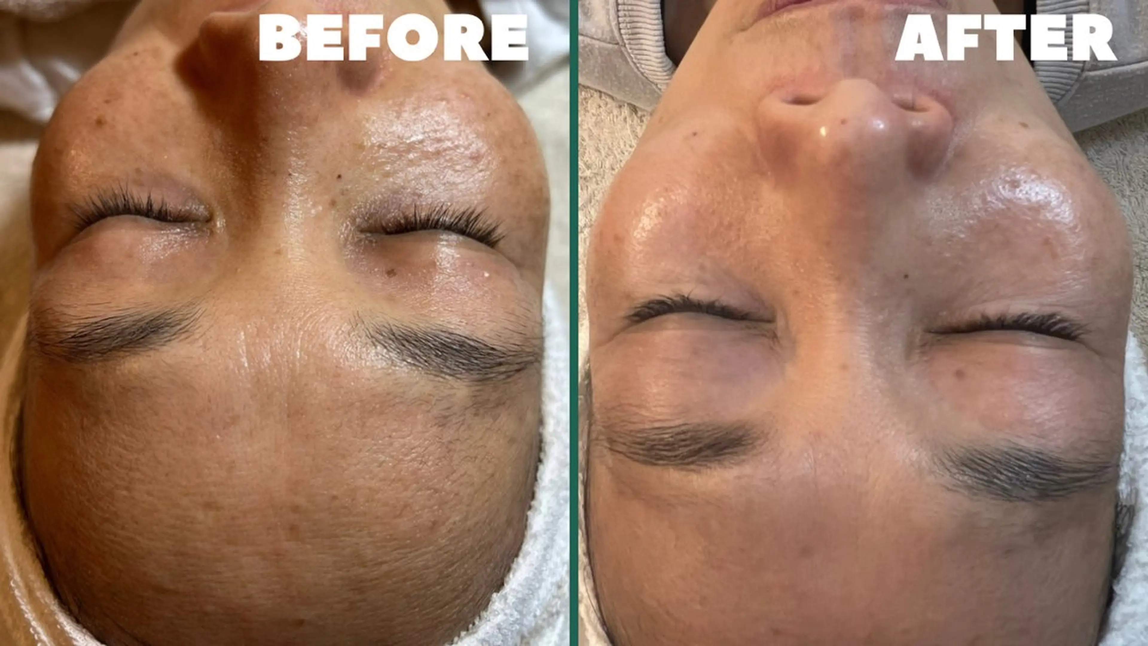 esty hitomiのエステ・リラクイメージ