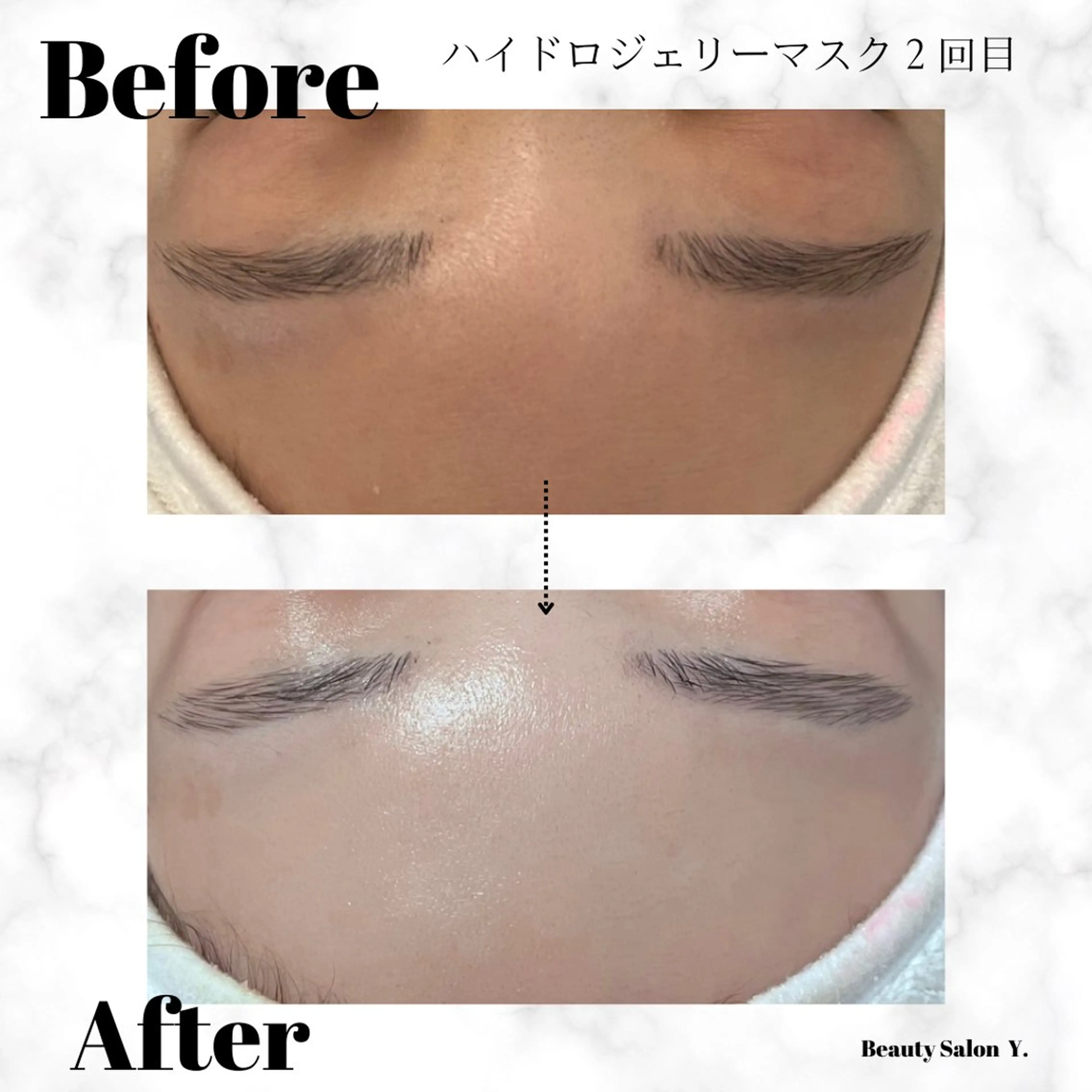 【1ヶ月通い放題】日焼けで傷んだお肌も瞬時に修復🖤2種類から選べるモデリングマスクケア💆‍♀️の写真