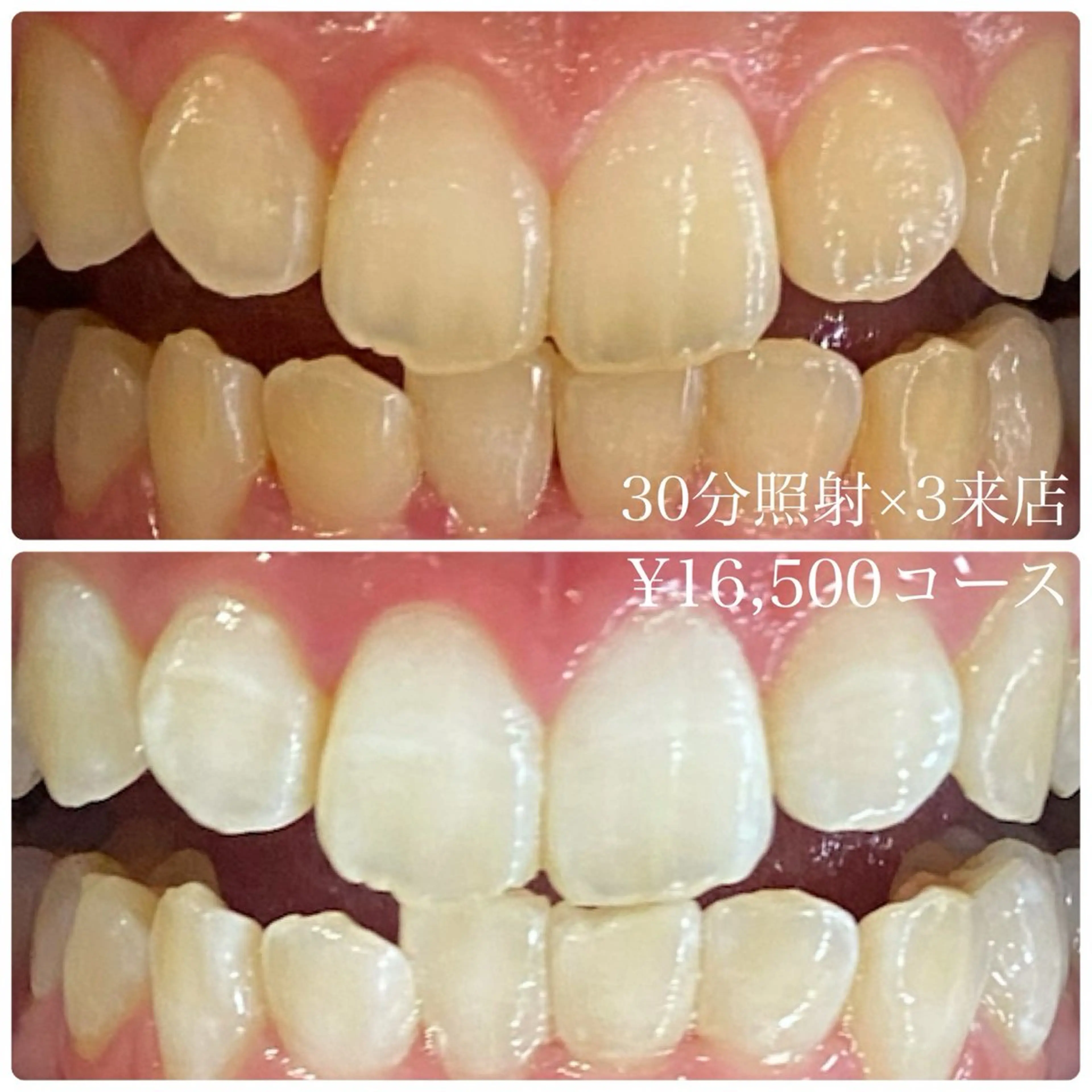 PLATINUM Beauty 横浜店所属・ホワイトニングルーム 横浜店のその他イメージ