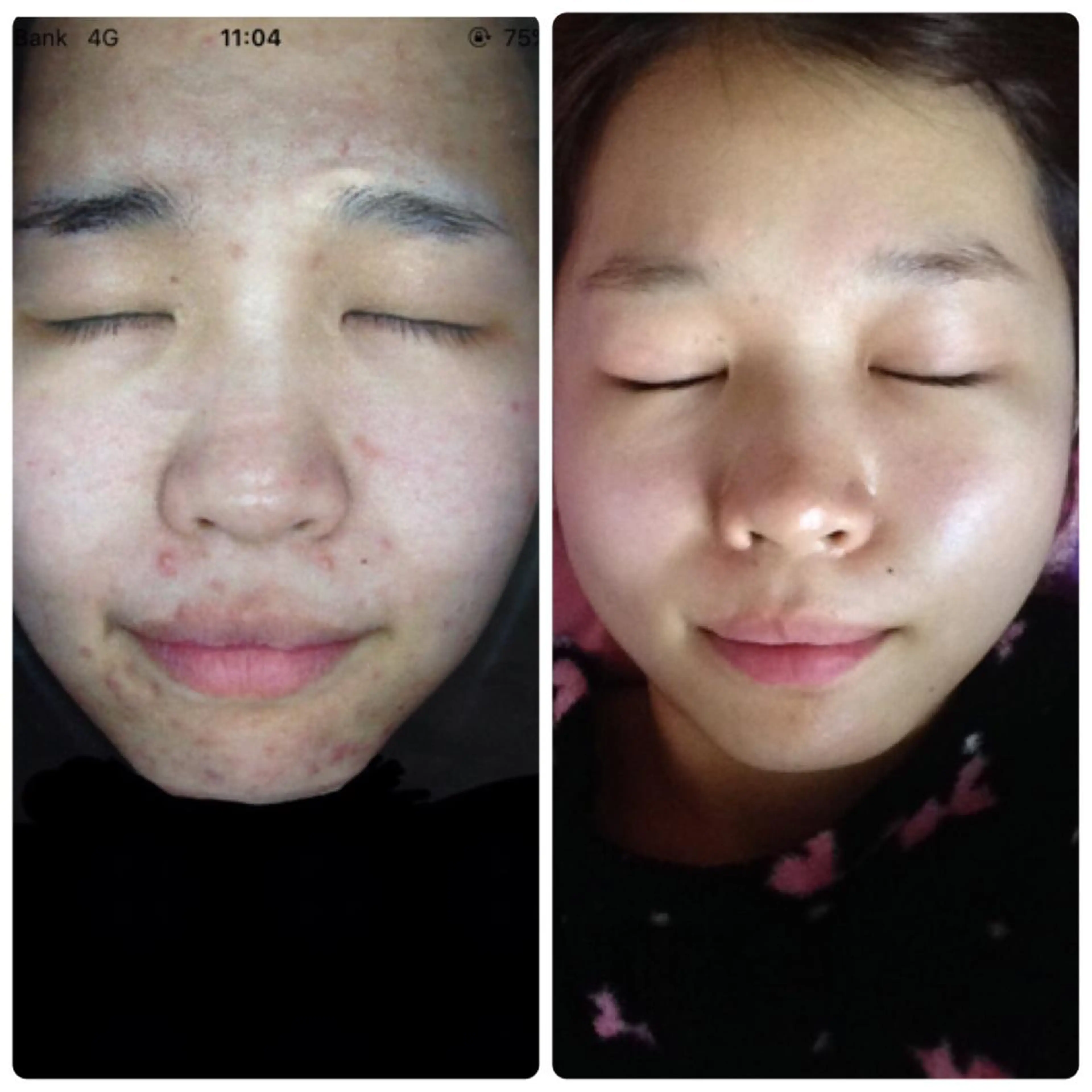 都度払い肌質改善 &脱毛Blancheのエステ・リラクイメージ