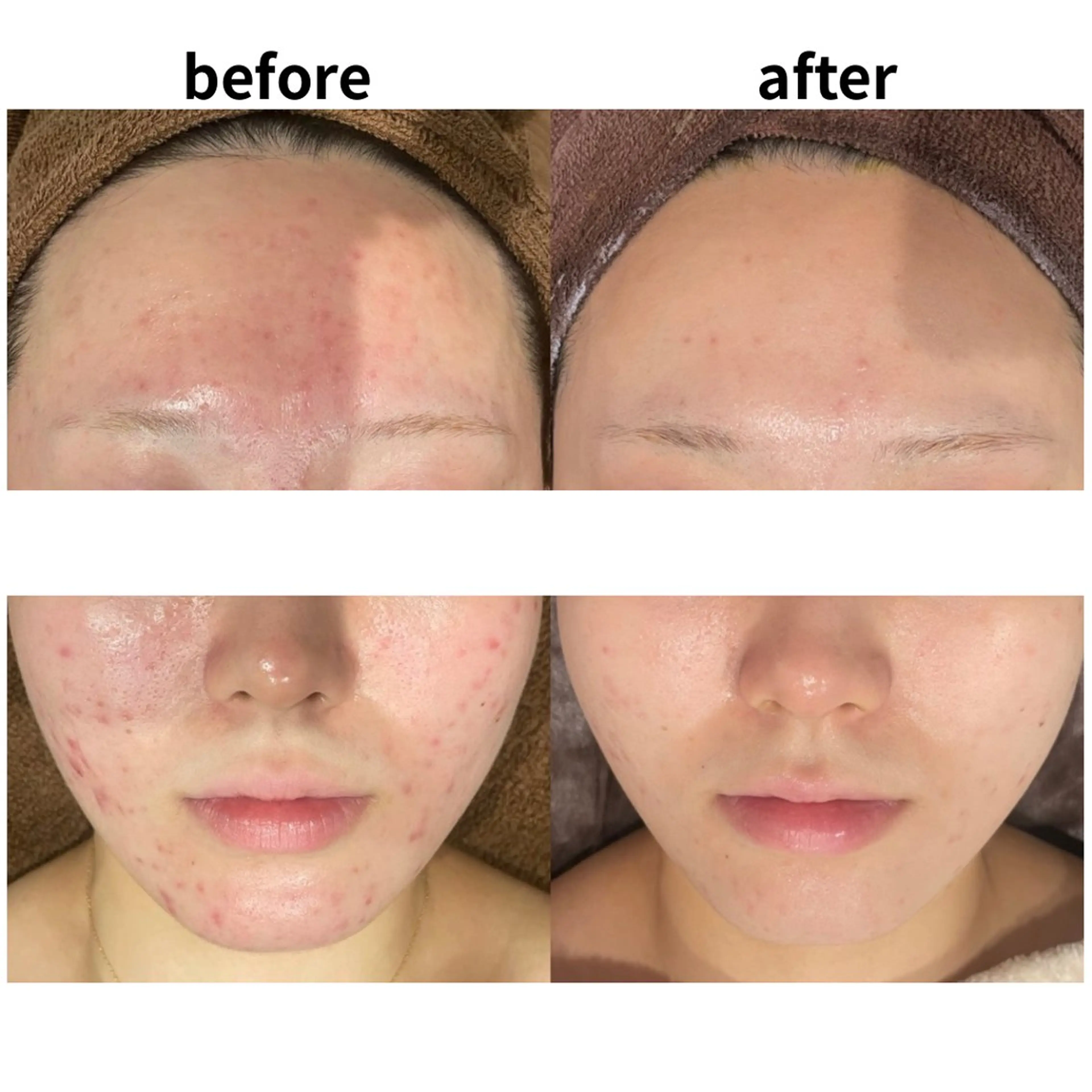 DahliaBeauty ダリアビューティー所属・DahliaBeau tyフェイシャル中村のエステ・リラクイメージ