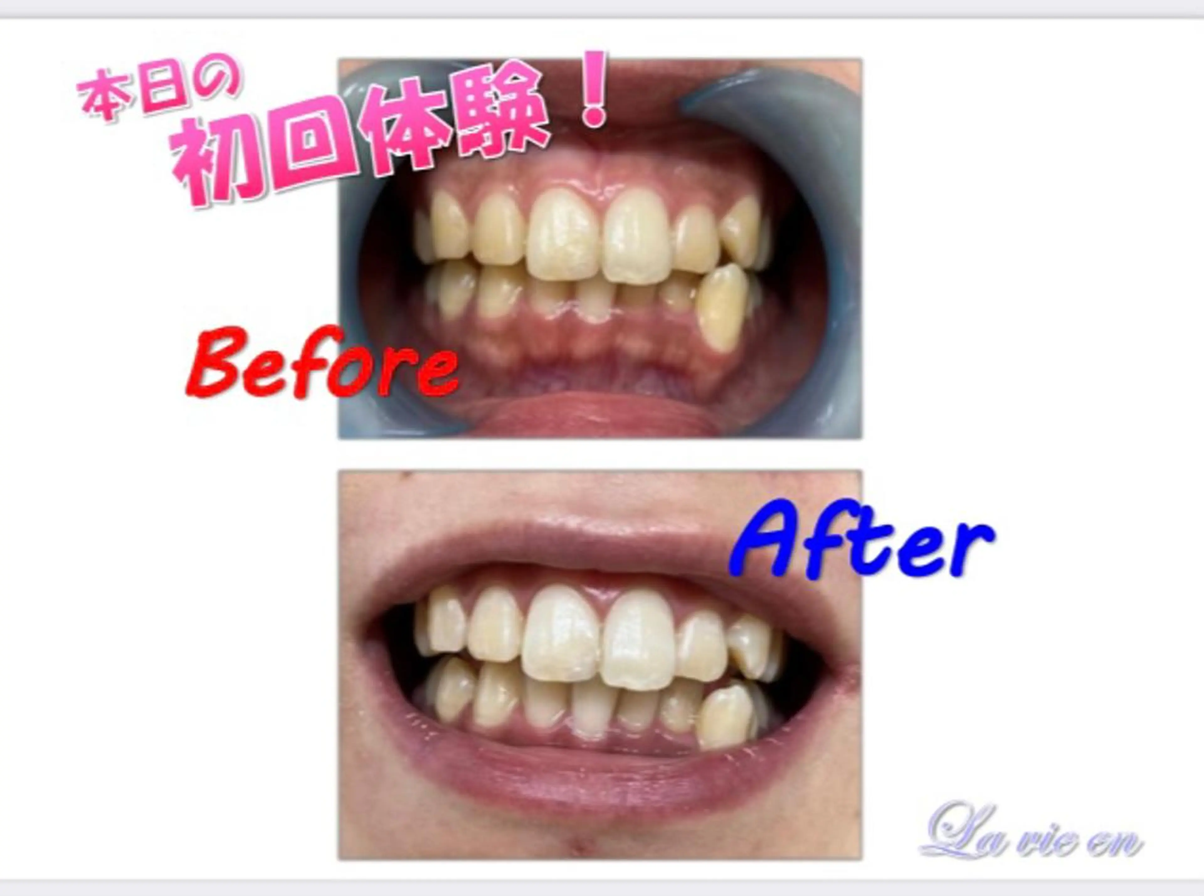 その他 セルフホワイトニングサロン　ラヴィアン所属・ホワイトニングサロン La vie enのその他イメージ