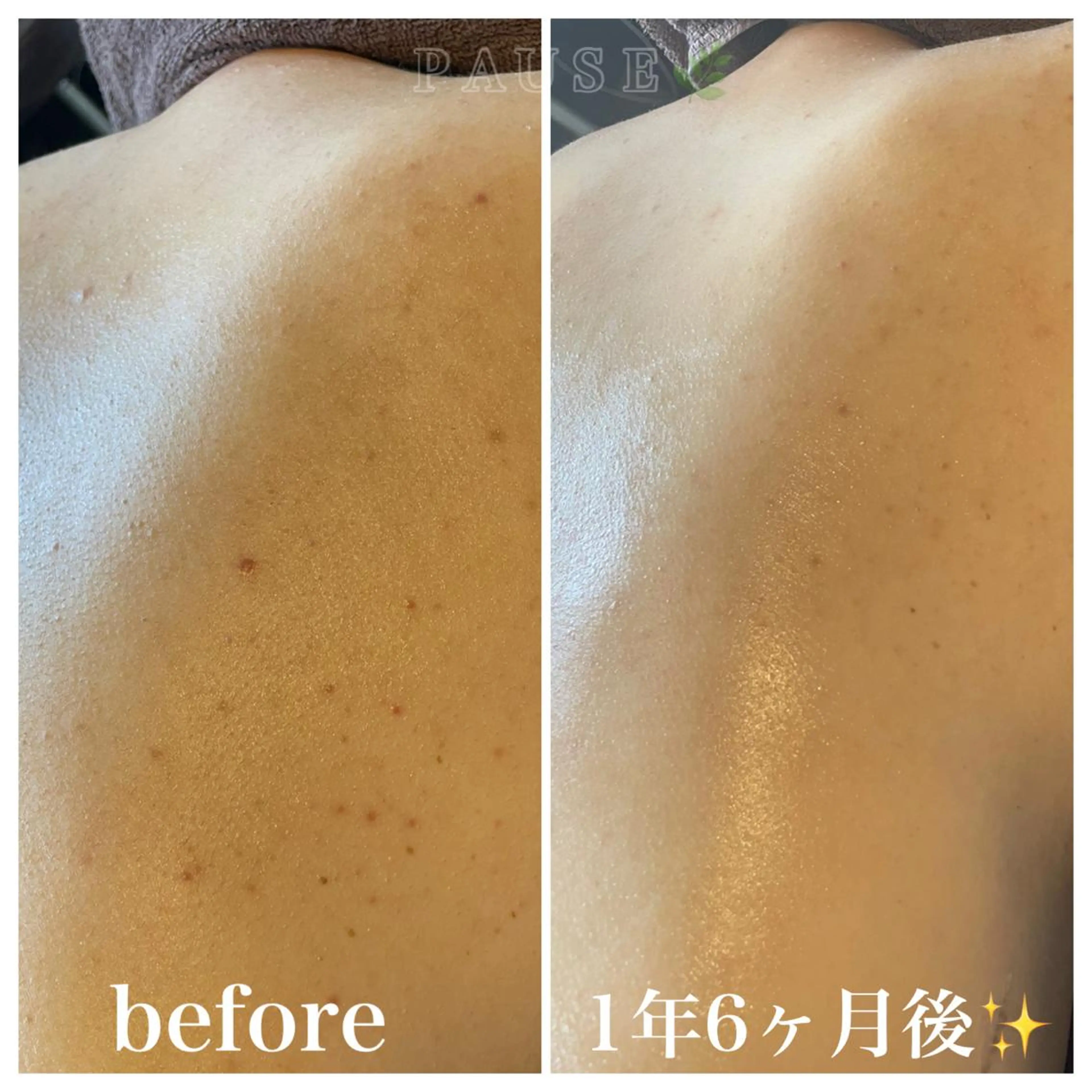 エステ 浜野 恵美のエステ・リラクイメージ