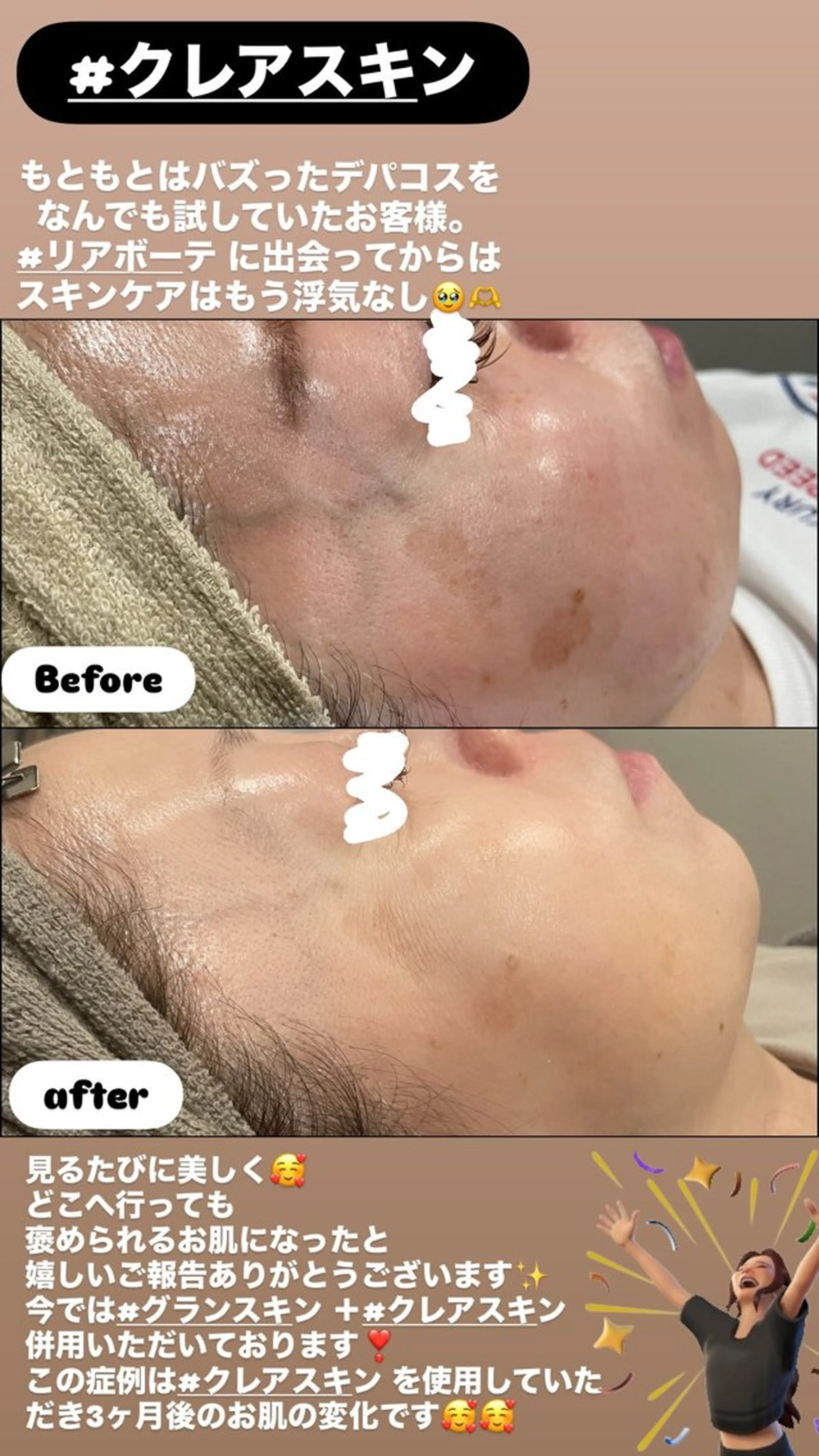 エステ LiZA エステティックサロンのエステ・リラクイメージ