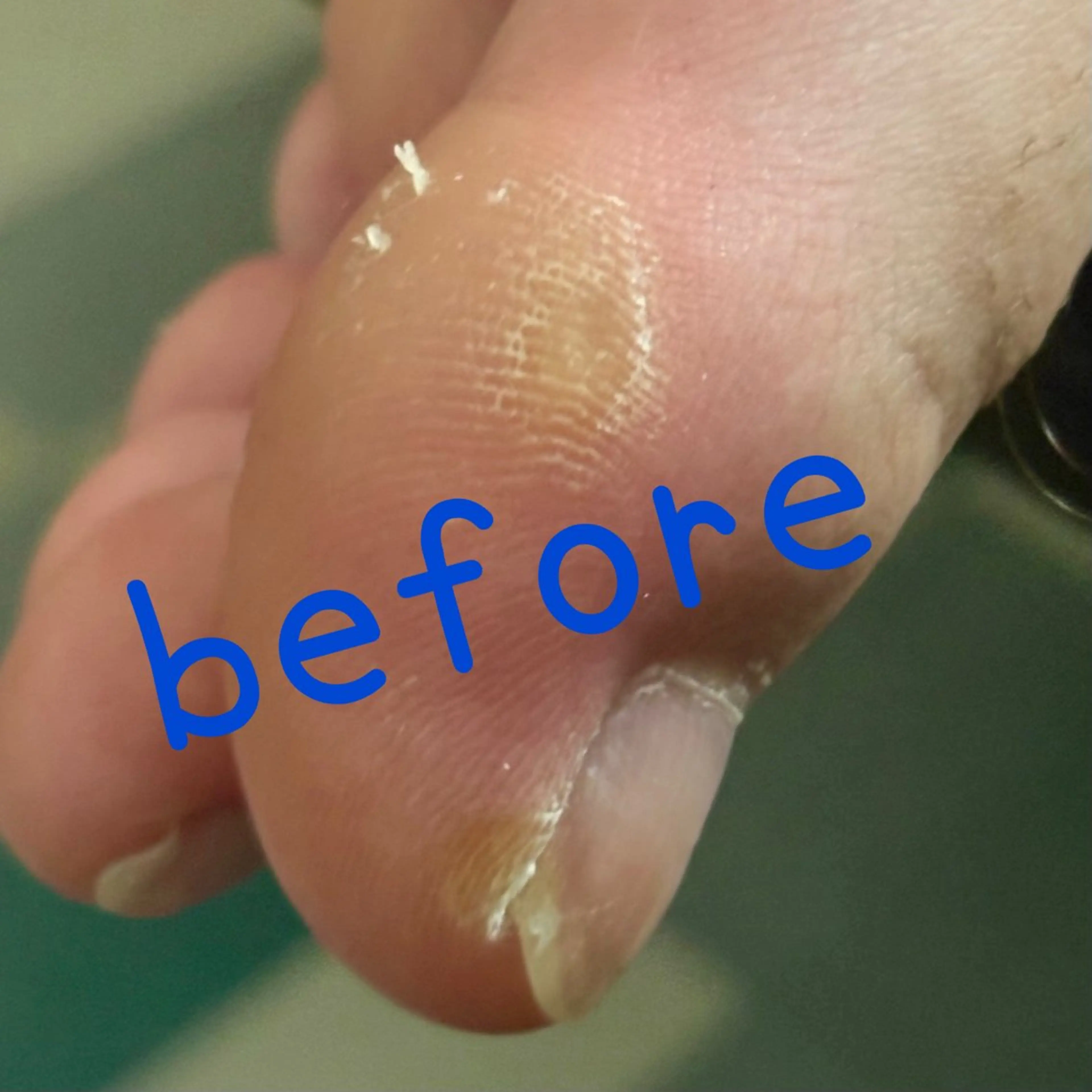 ネイル フットネイル みんなのネイルサロン IRiS所属・一人ひとりに寄り添う 施術🌈IRiS🪽のネイルデザイン