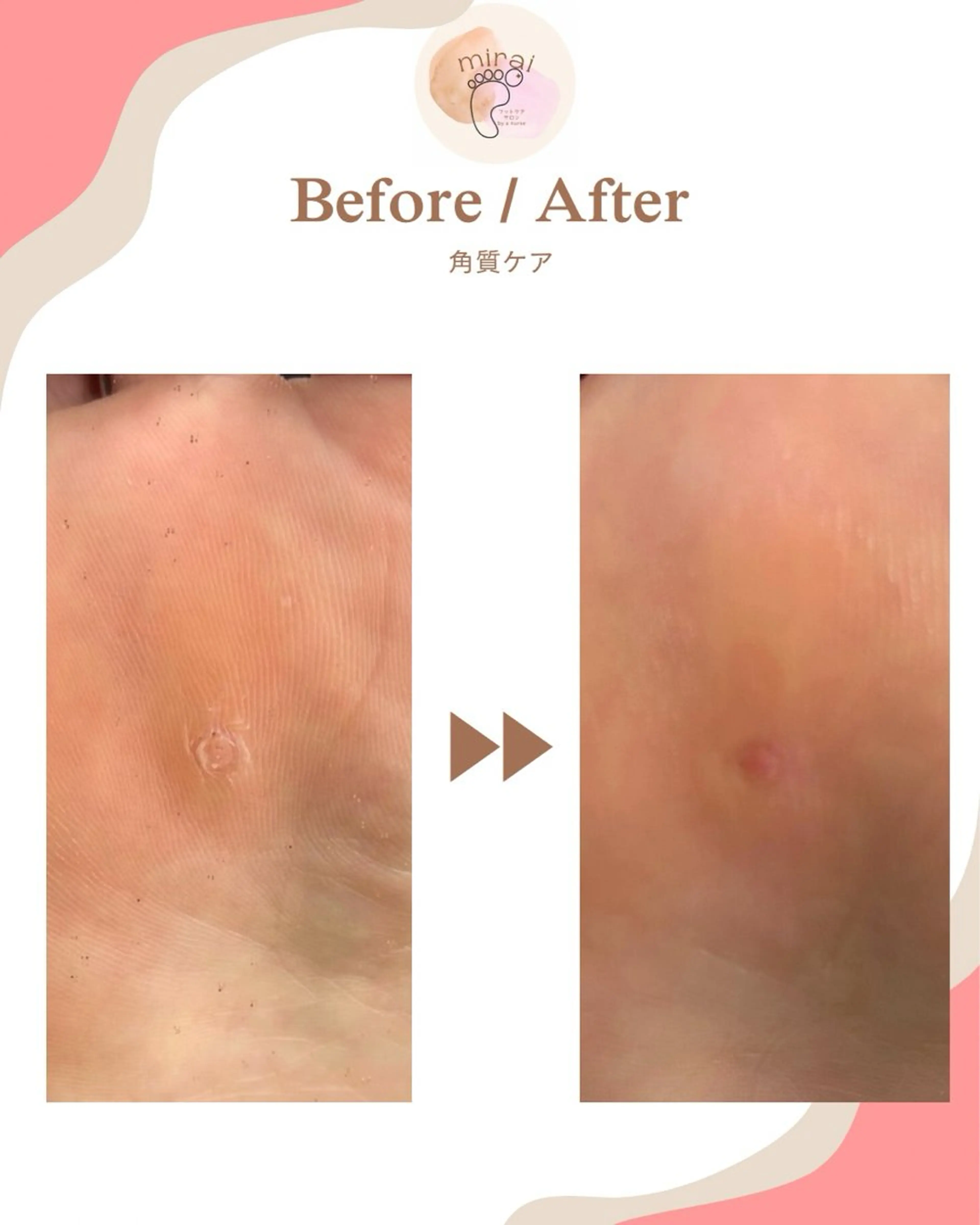 その他 フットケアサロン miraiのその他イメージ