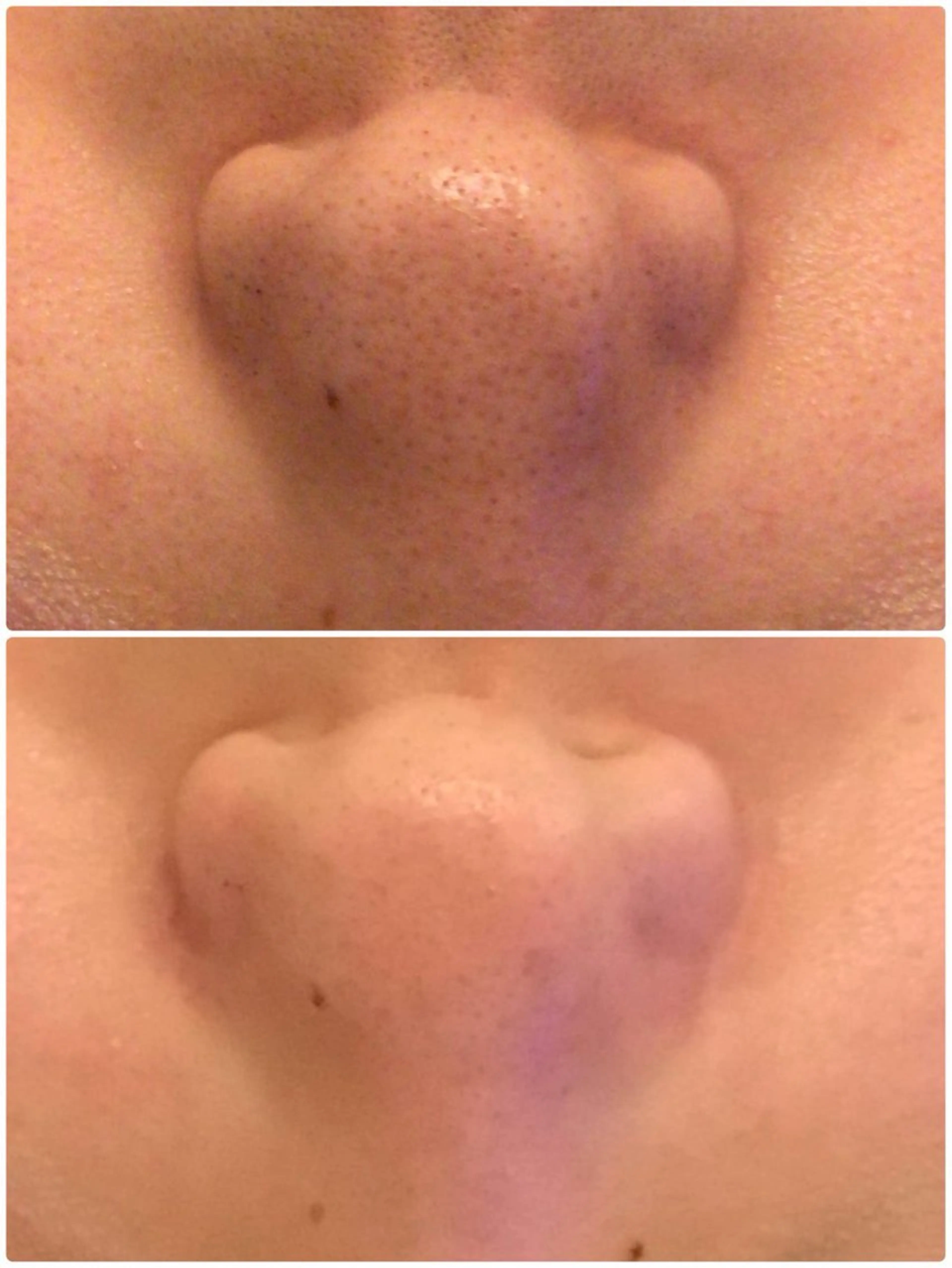 毛穴専門店Bébéもりの里店所属・毛穴専門店Bébé もりの里店のエステ・リラクイメージ