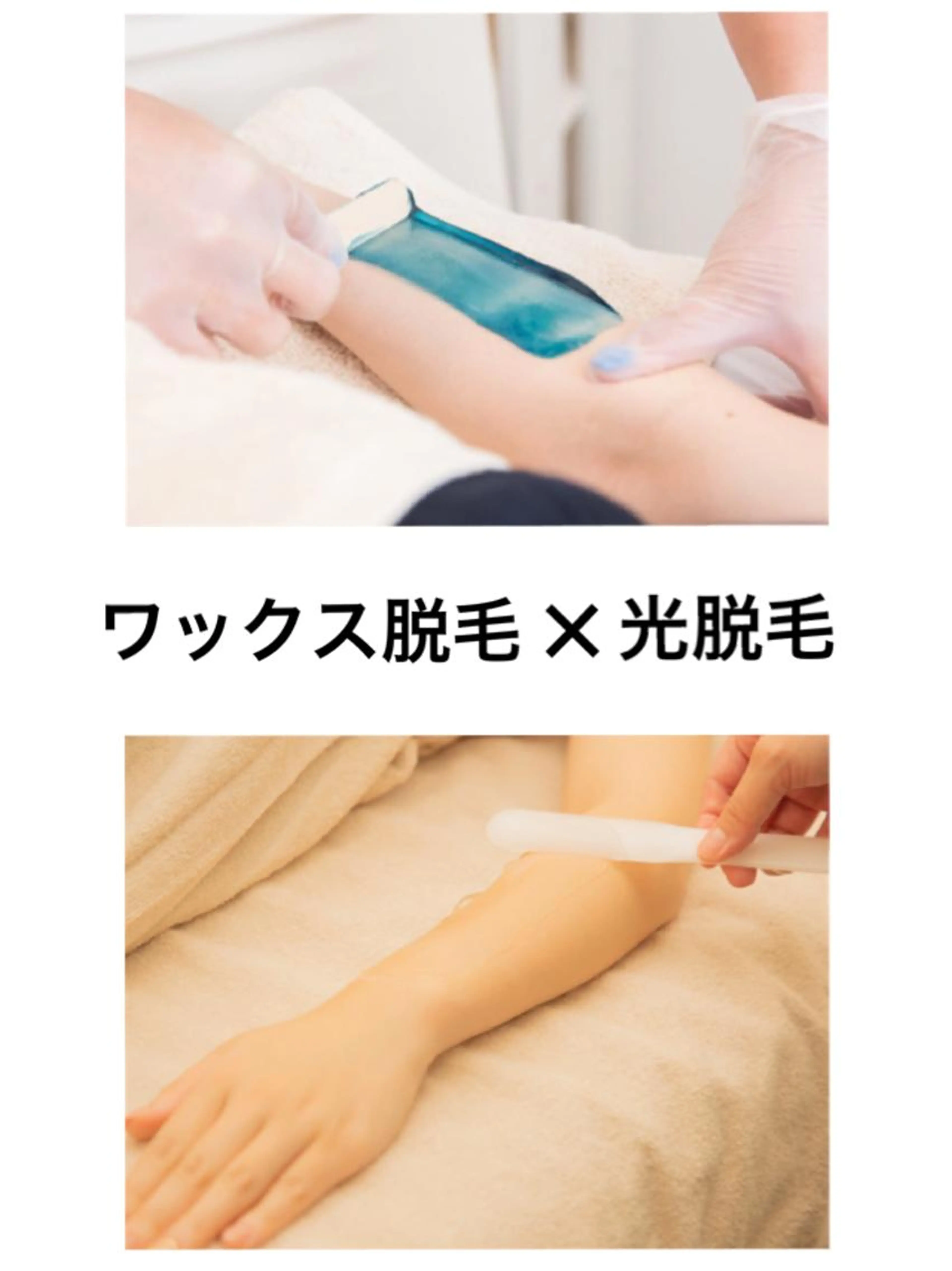 レディース【MIX脱毛】VIO(ブラジリアンワックス＋最新美容脱毛)の写真