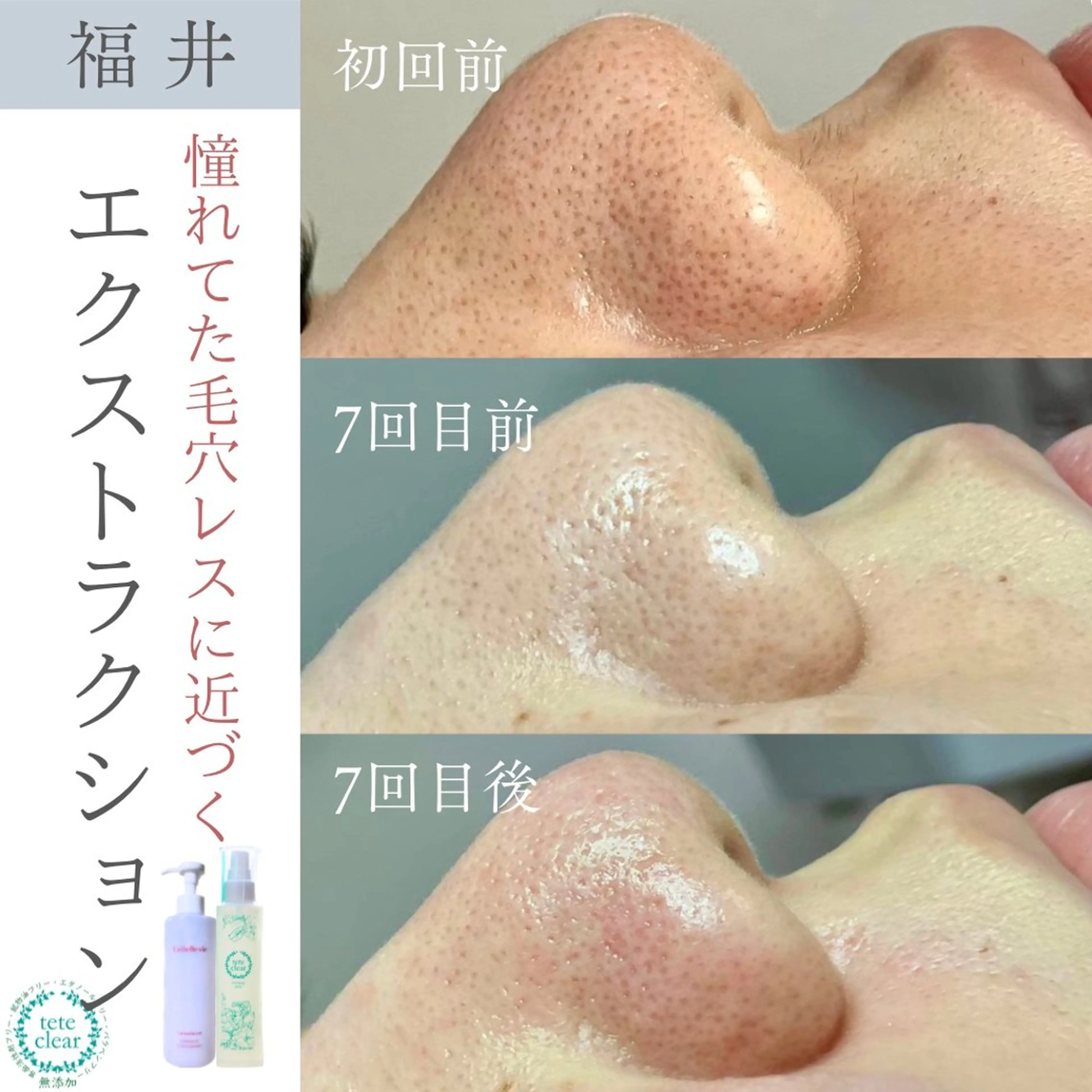毛穴ケア専門サロン Yourmeユアミーのエステ・リラクイメージ