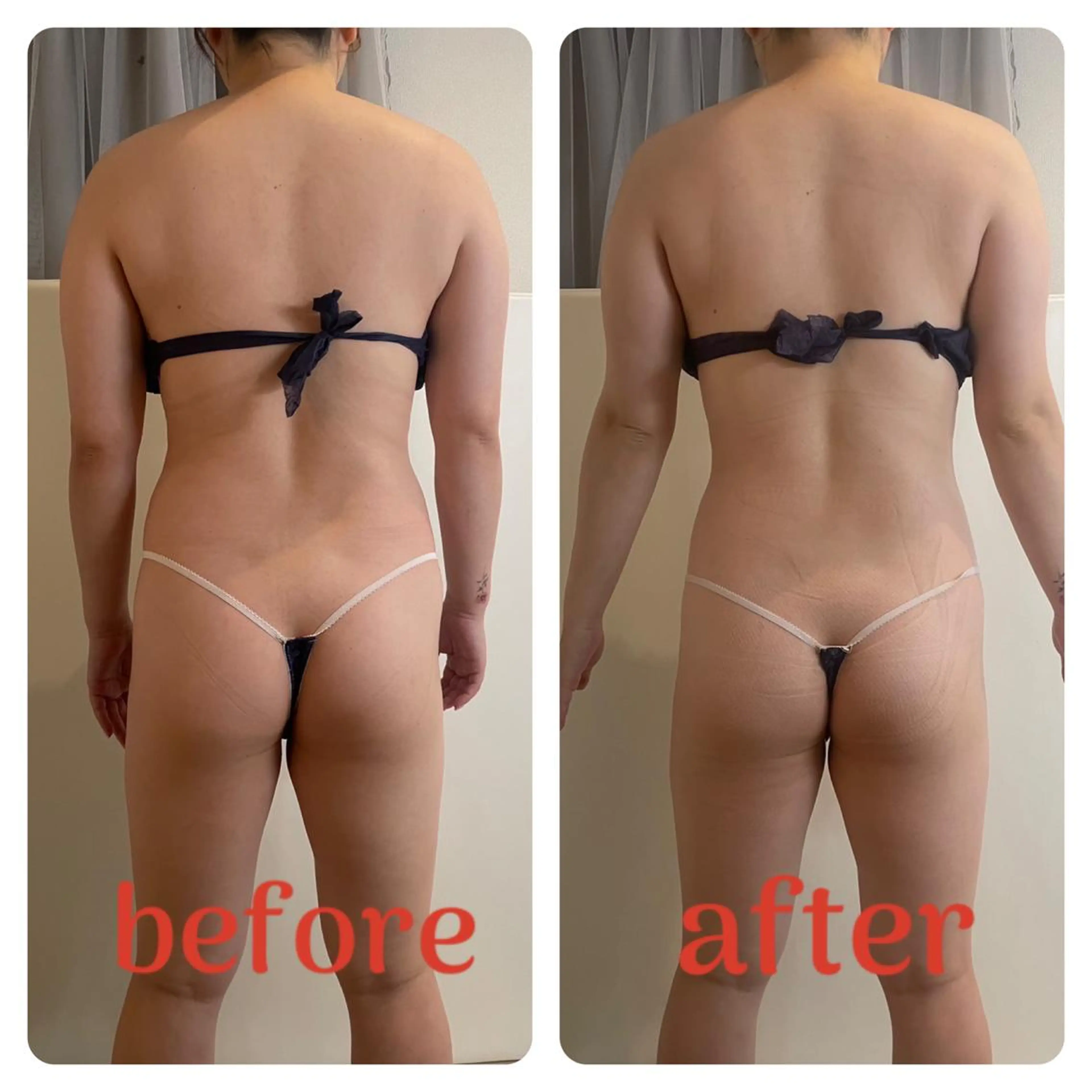 エステ インディバサロン LILY  新宿御苑のエステ・リラクイメージ