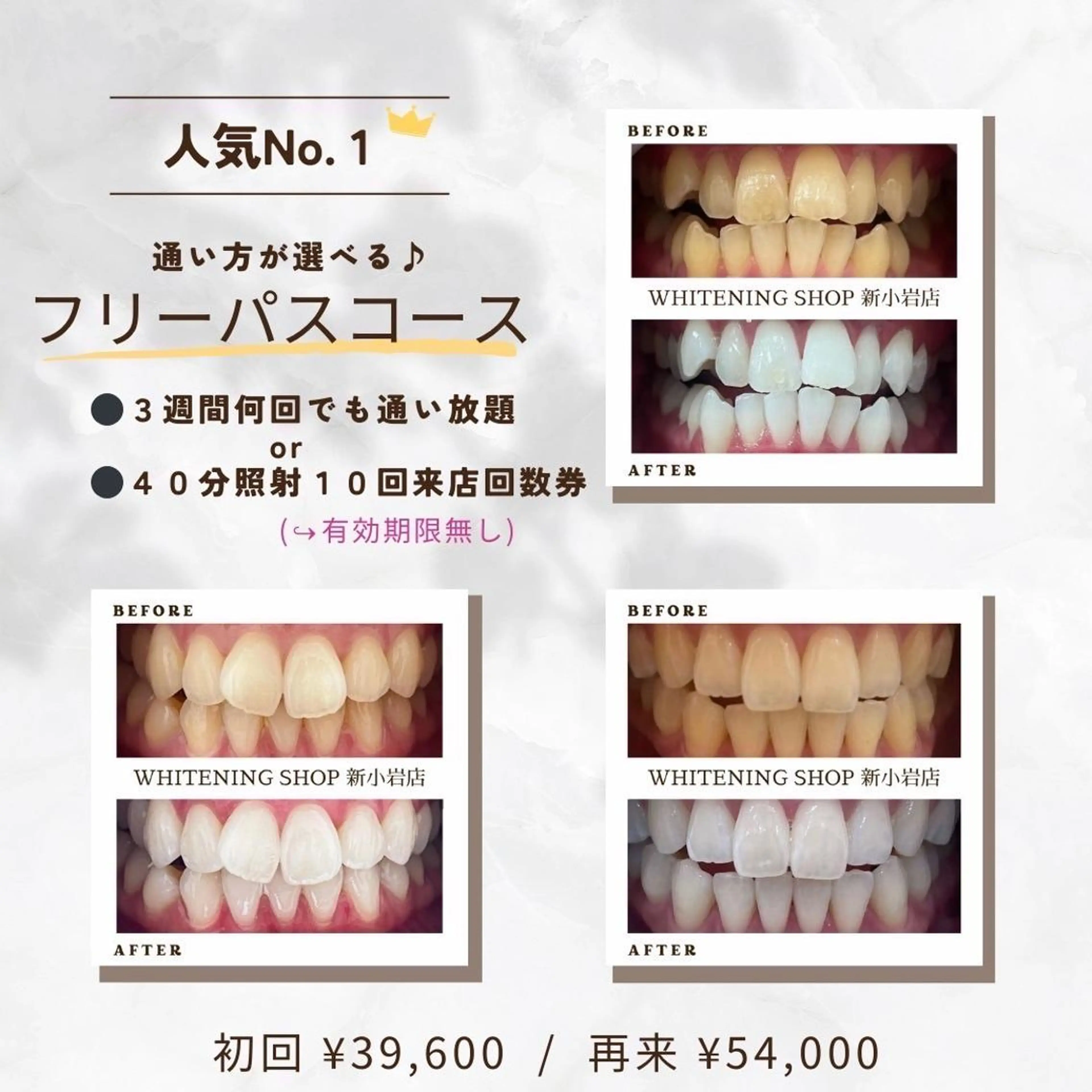 メンズ その他 ホワイトニング ショップ新小岩店のその他イメージ