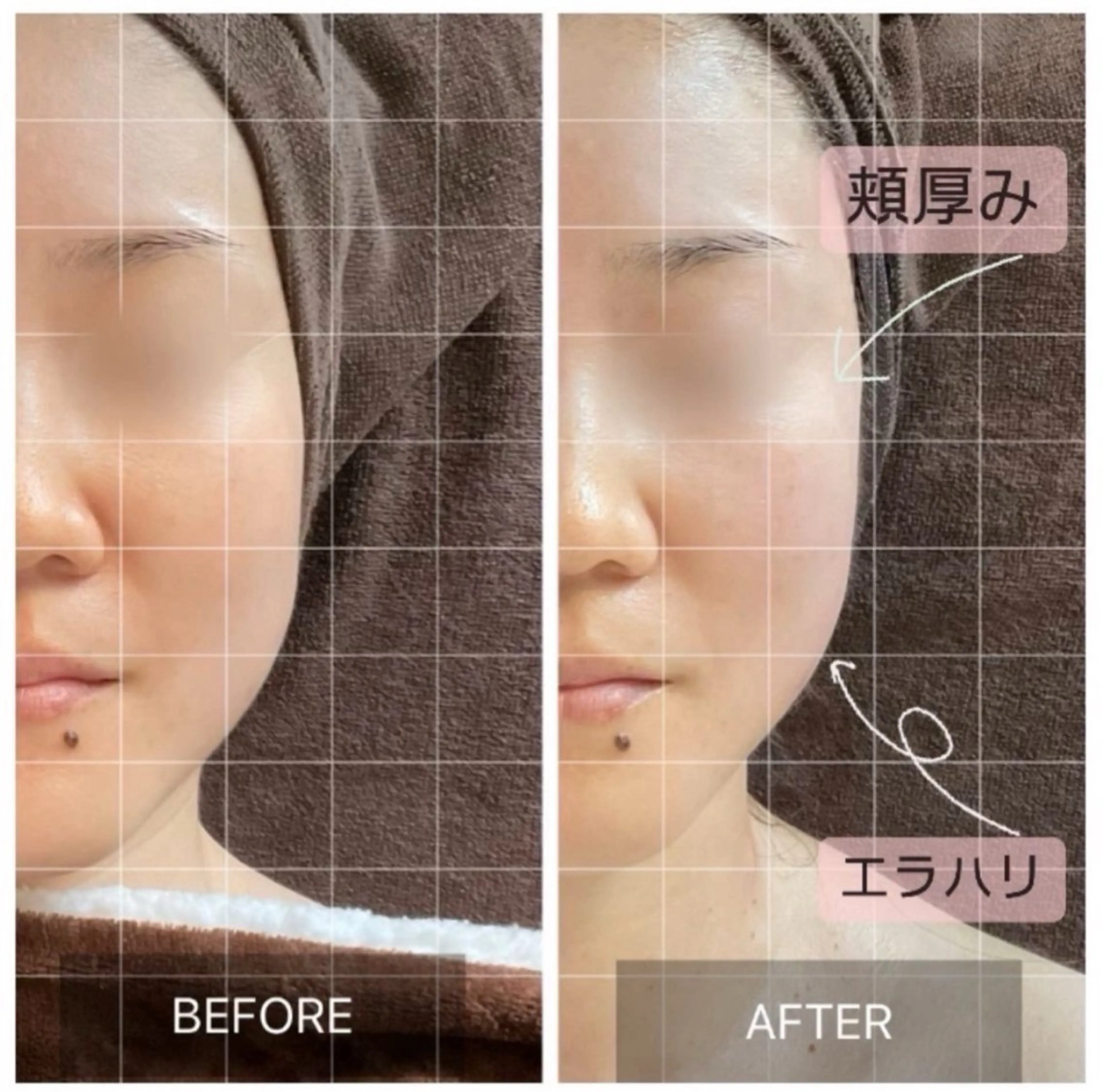 【フェイスUP×美白コース】（90min)の写真