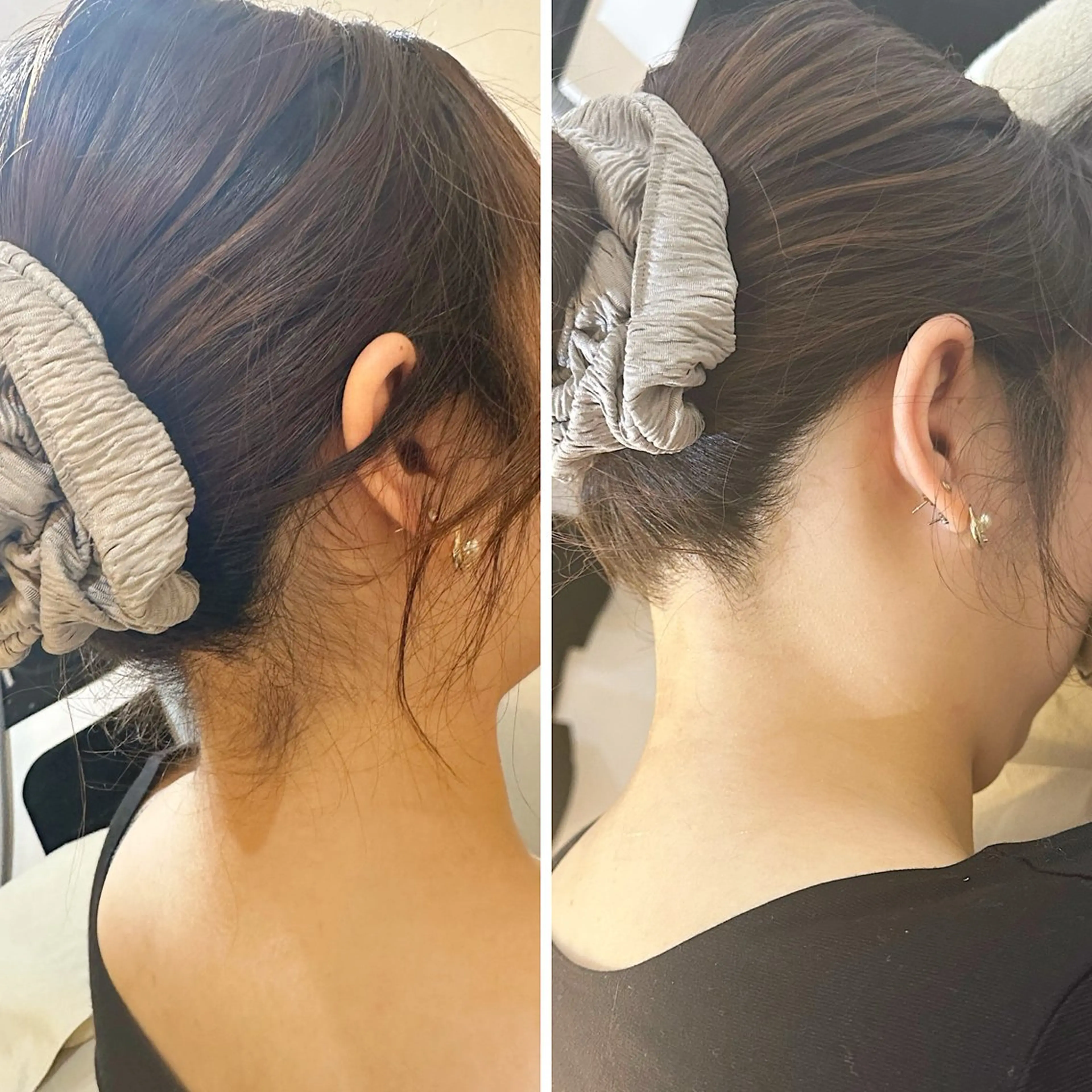 脱毛 うなじ脱毛/美肌脱毛 LABELのエステ・リラクイメージ