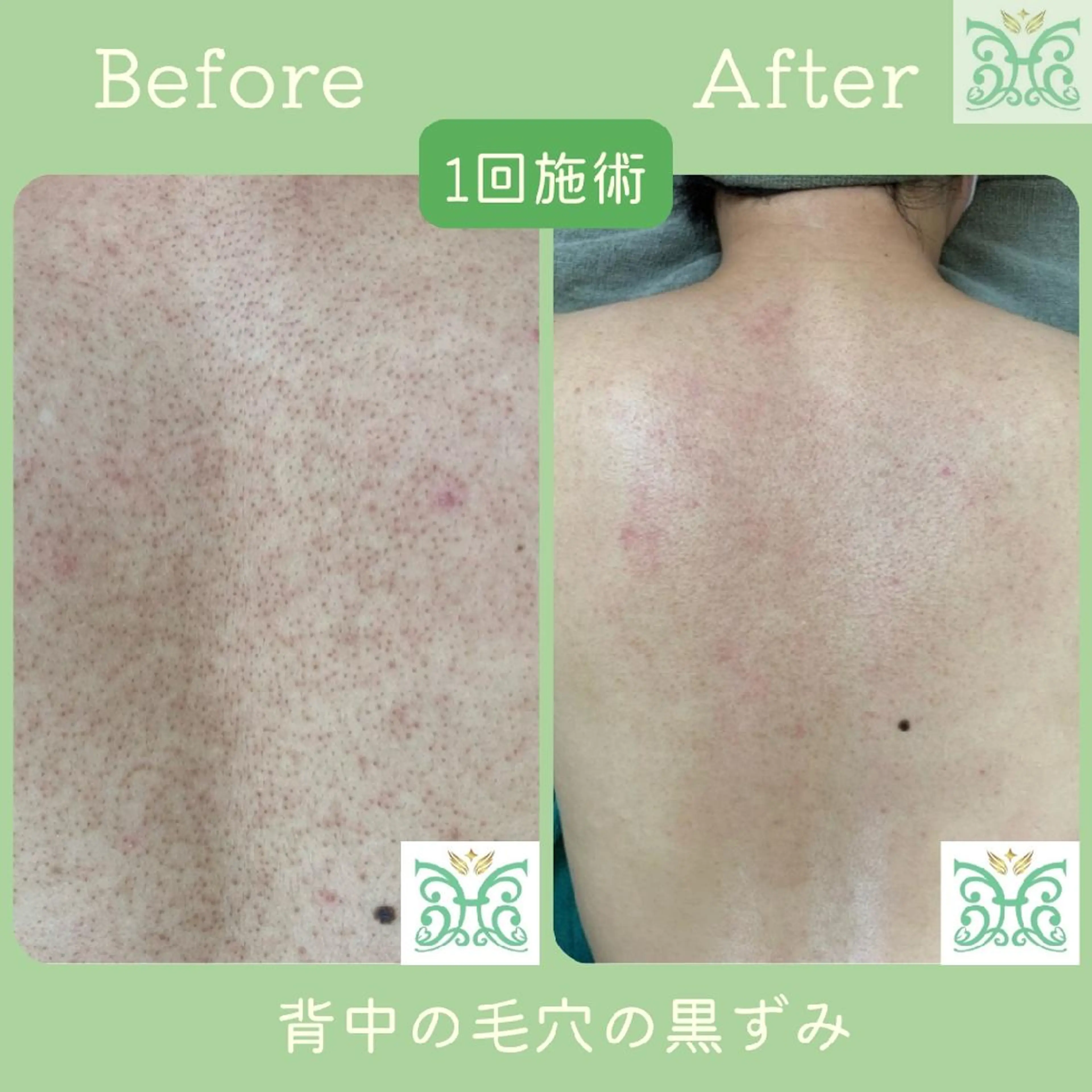 エステ 剥離するハーブ🌈 Honey Sideのエステ・リラクイメージ