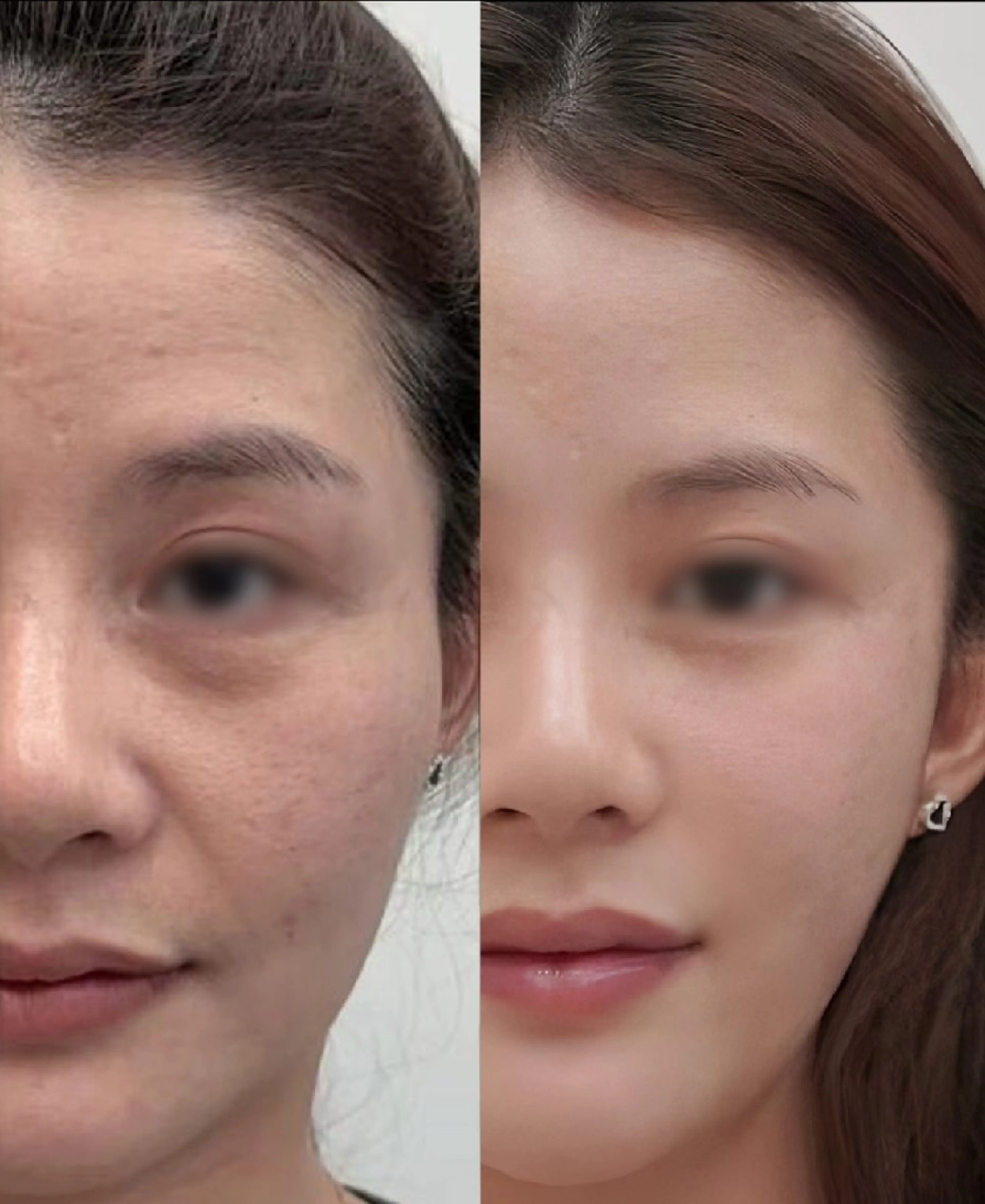 アイブロウ 眉毛ワックス脱毛 aliaハイフ&水光ジェットサロン所属・aliaハーブ水光店 エステティシャン募集のエステ・リラクイメージ