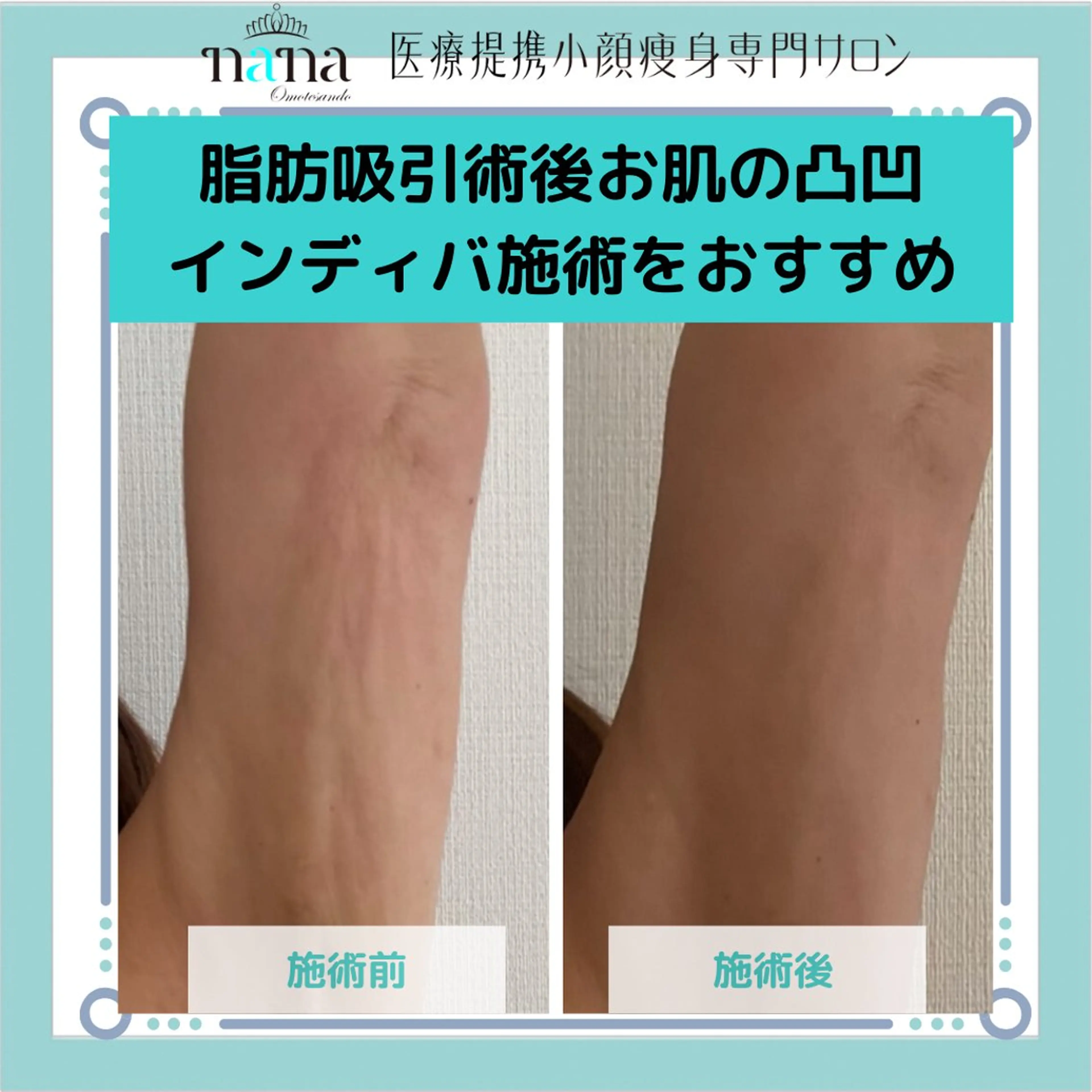 エステ リラク 小顔痩身インディバ Nana表参道のエステ・リラクイメージ