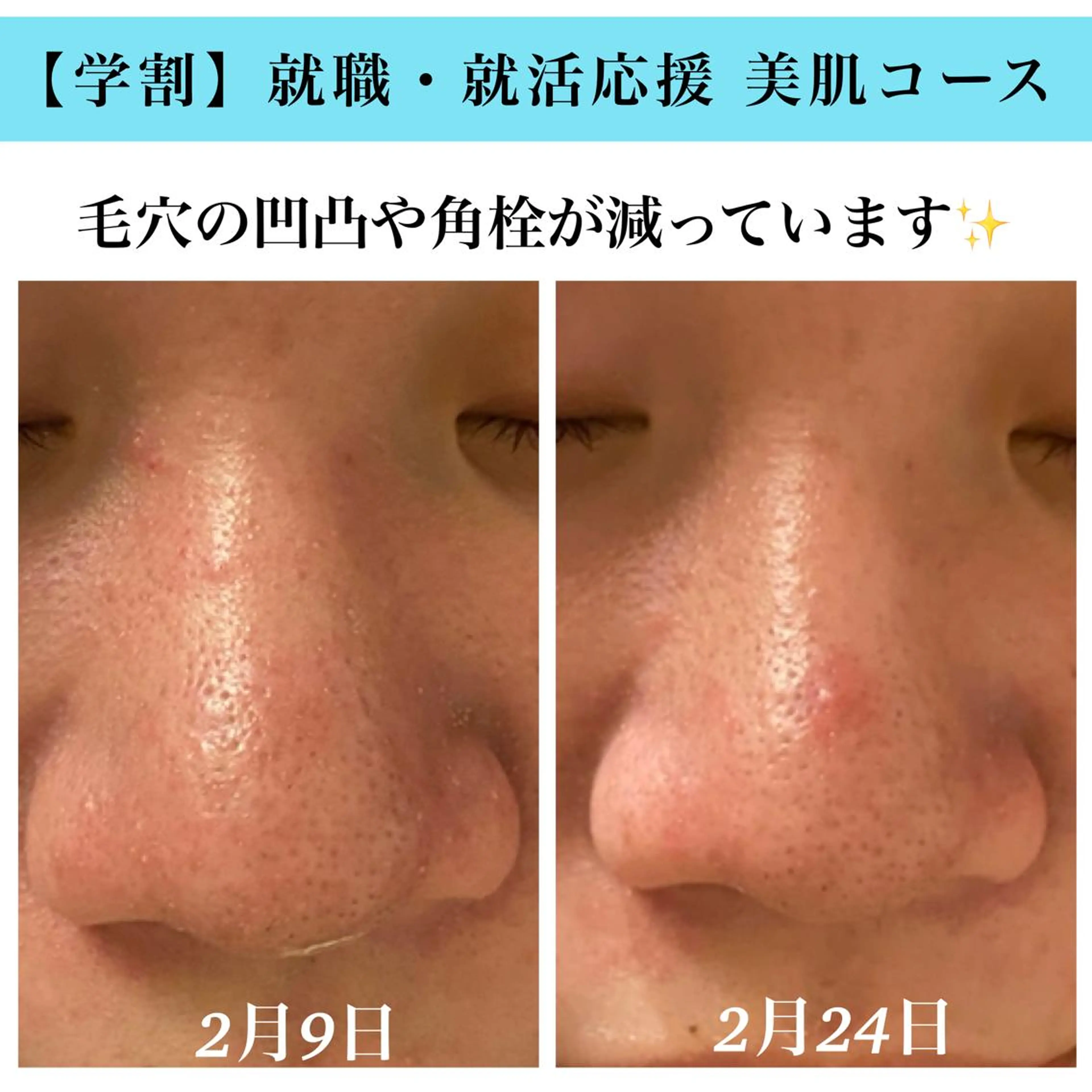 エステ Bellesthe (ベルエステ)のエステ・リラクイメージ