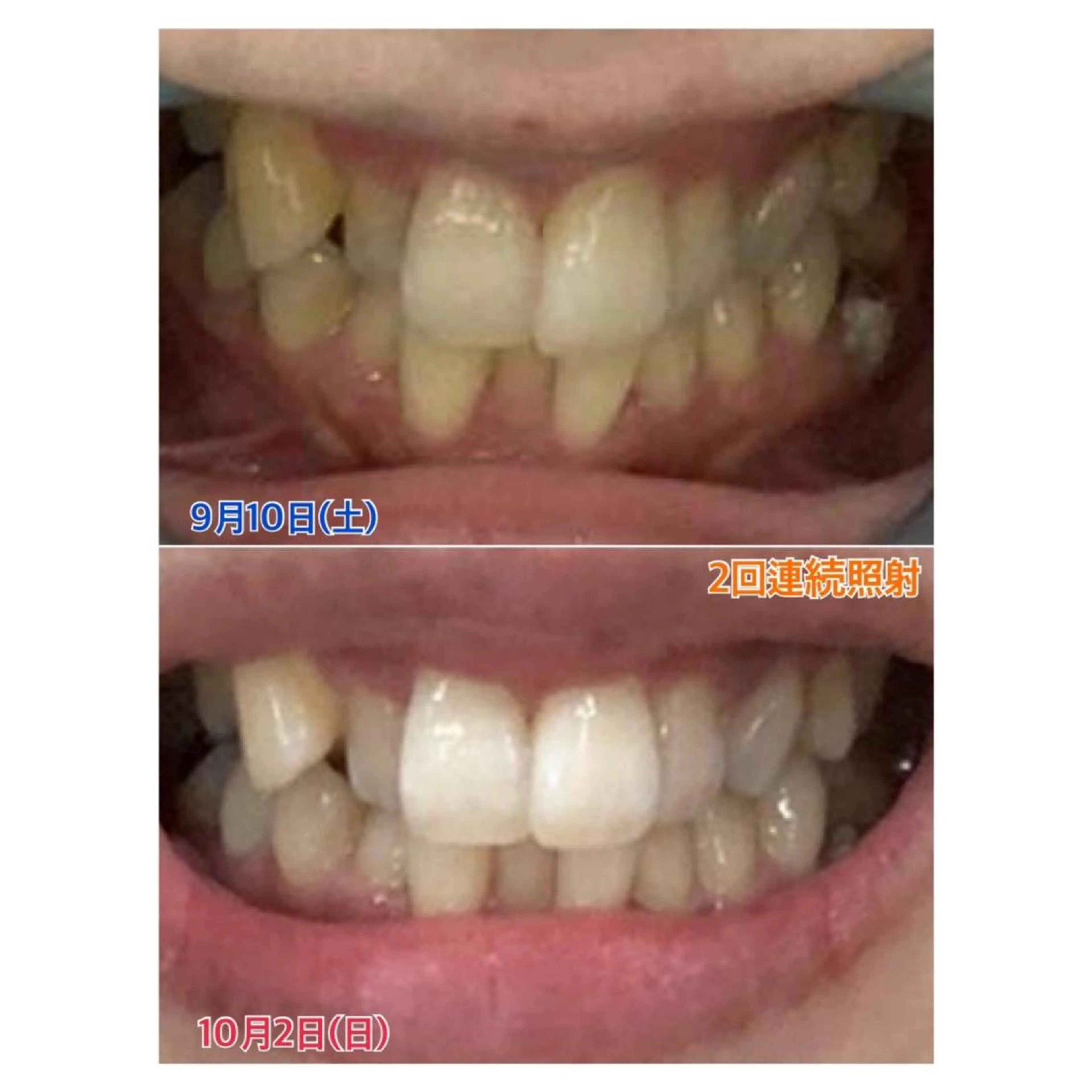 MBEAUTYSALON 千葉店・京成大久保所属・Melty 輝のその他イメージ