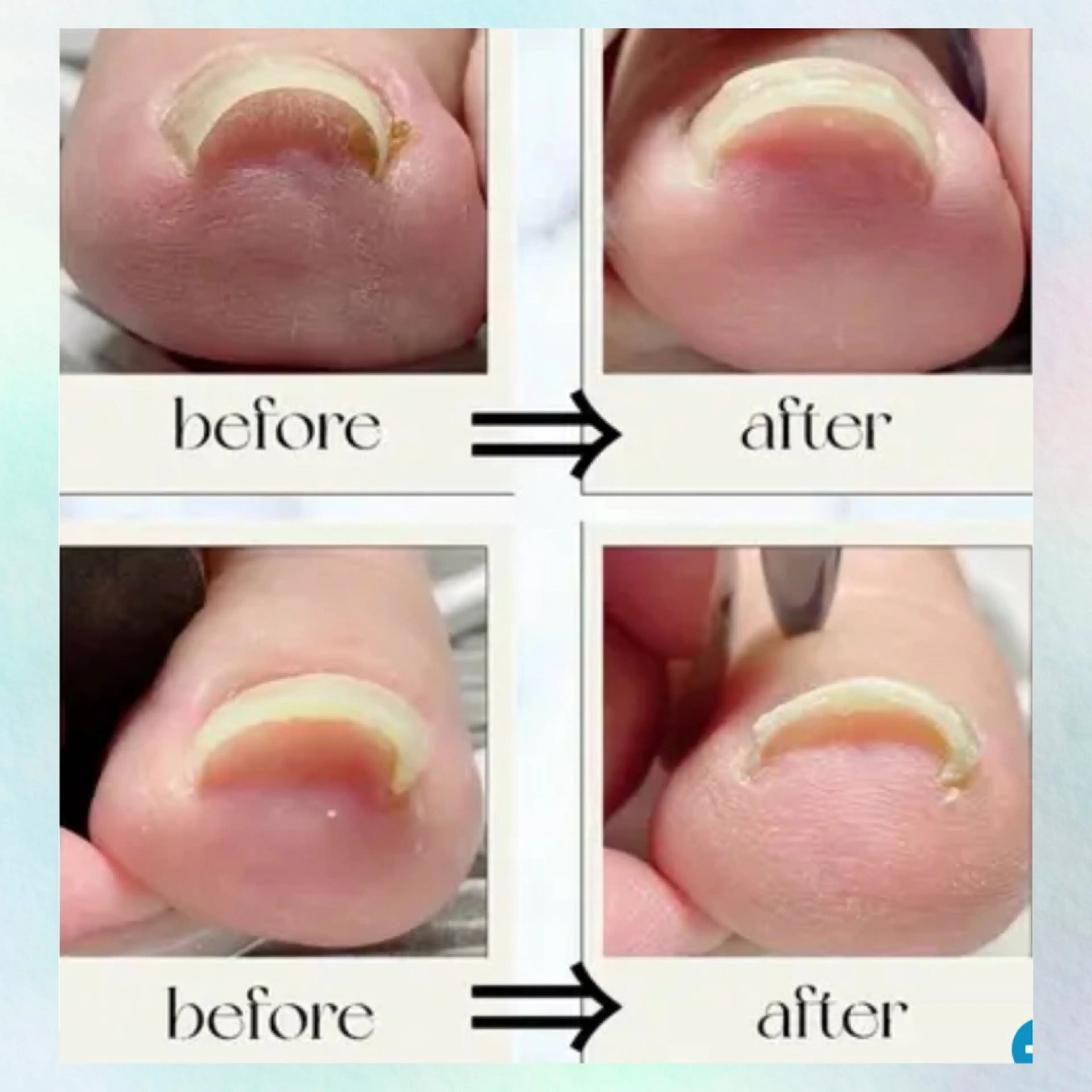 ネイル フットネイル ジェルネイル その他(ネイル) NAIL K-PIT ネイル ケーピットのネイルデザイン