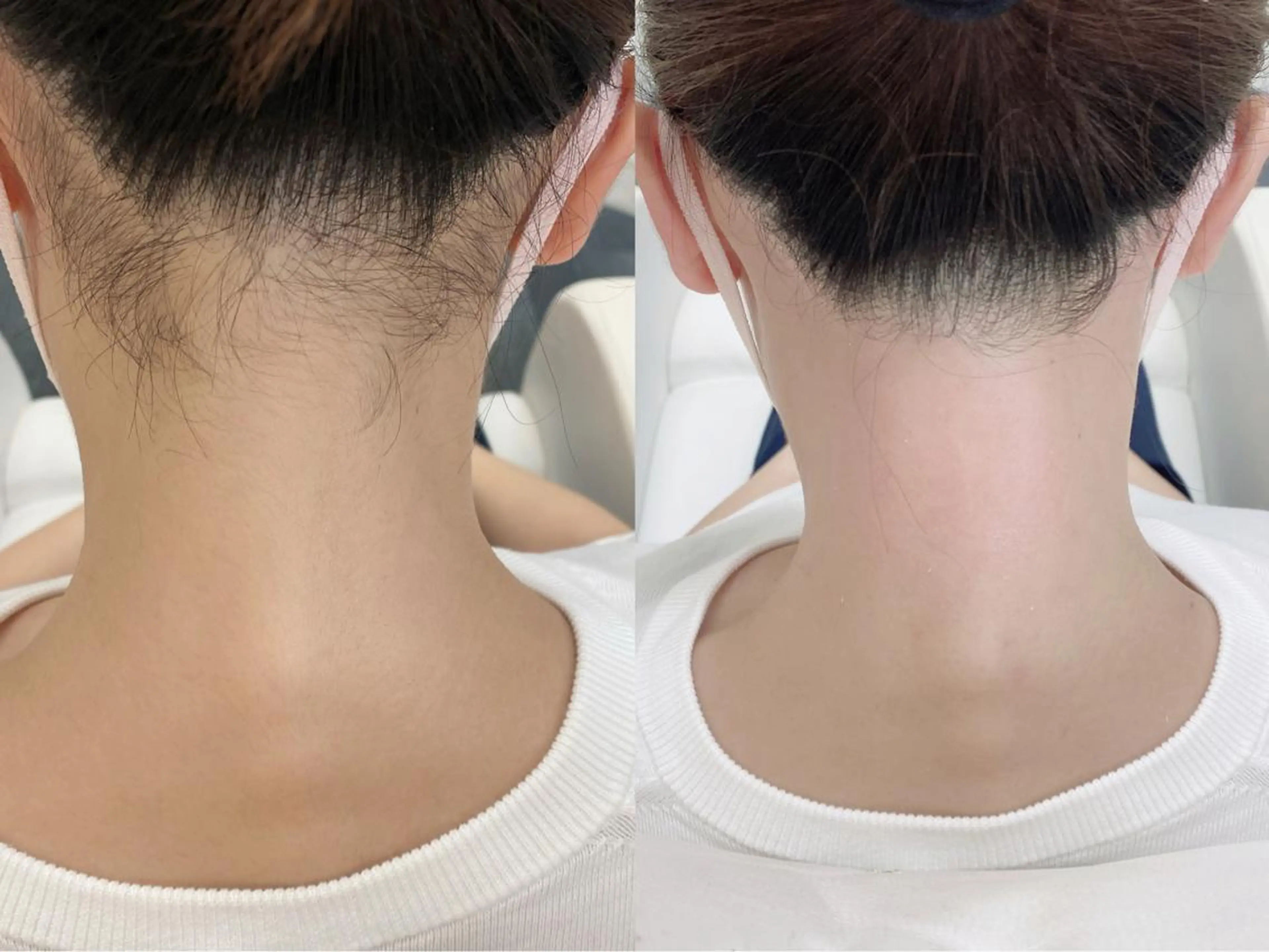 エステ Grace naoのマツエク・マツパデザイン