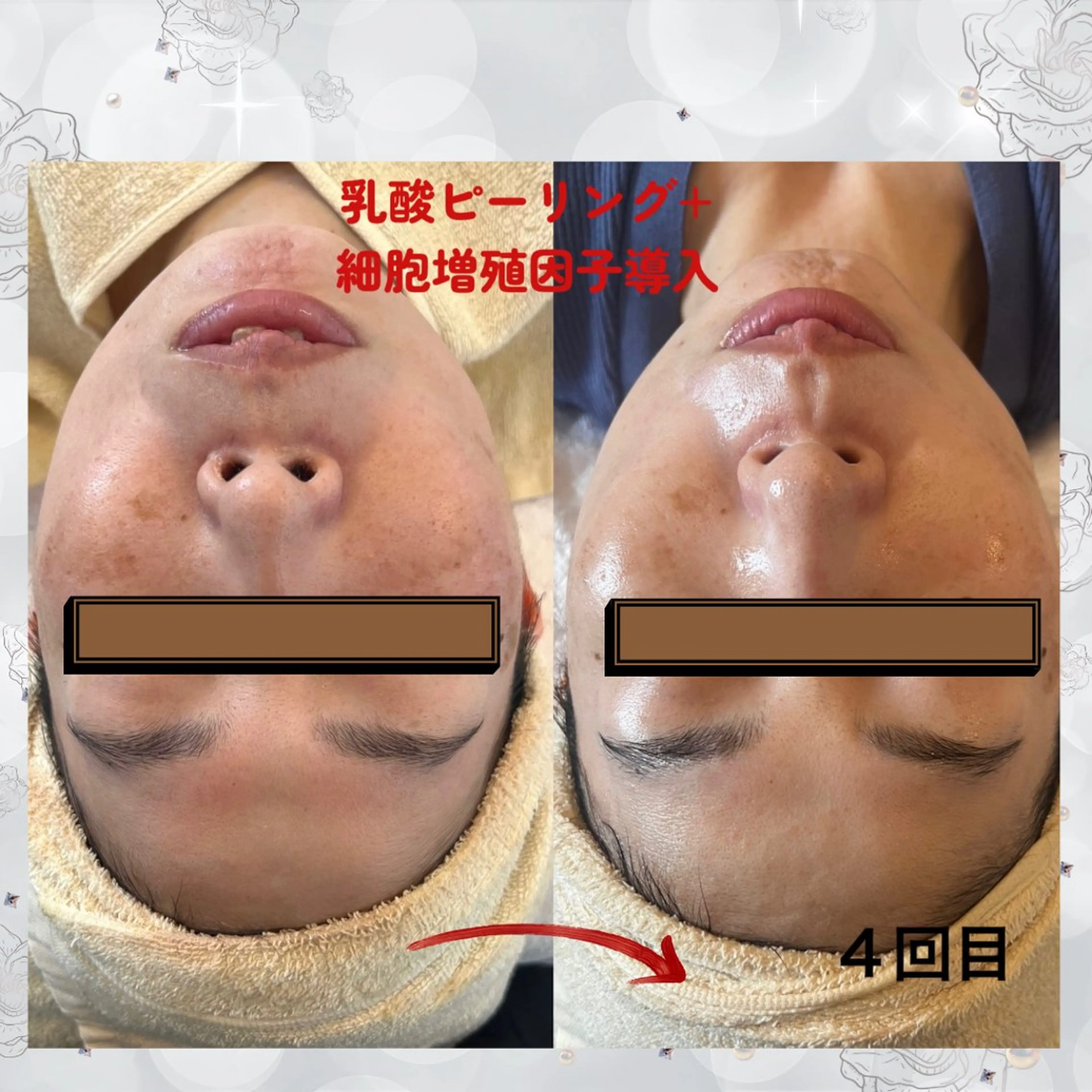 エステ beauty SalonRcoinのマツエク・マツパデザイン