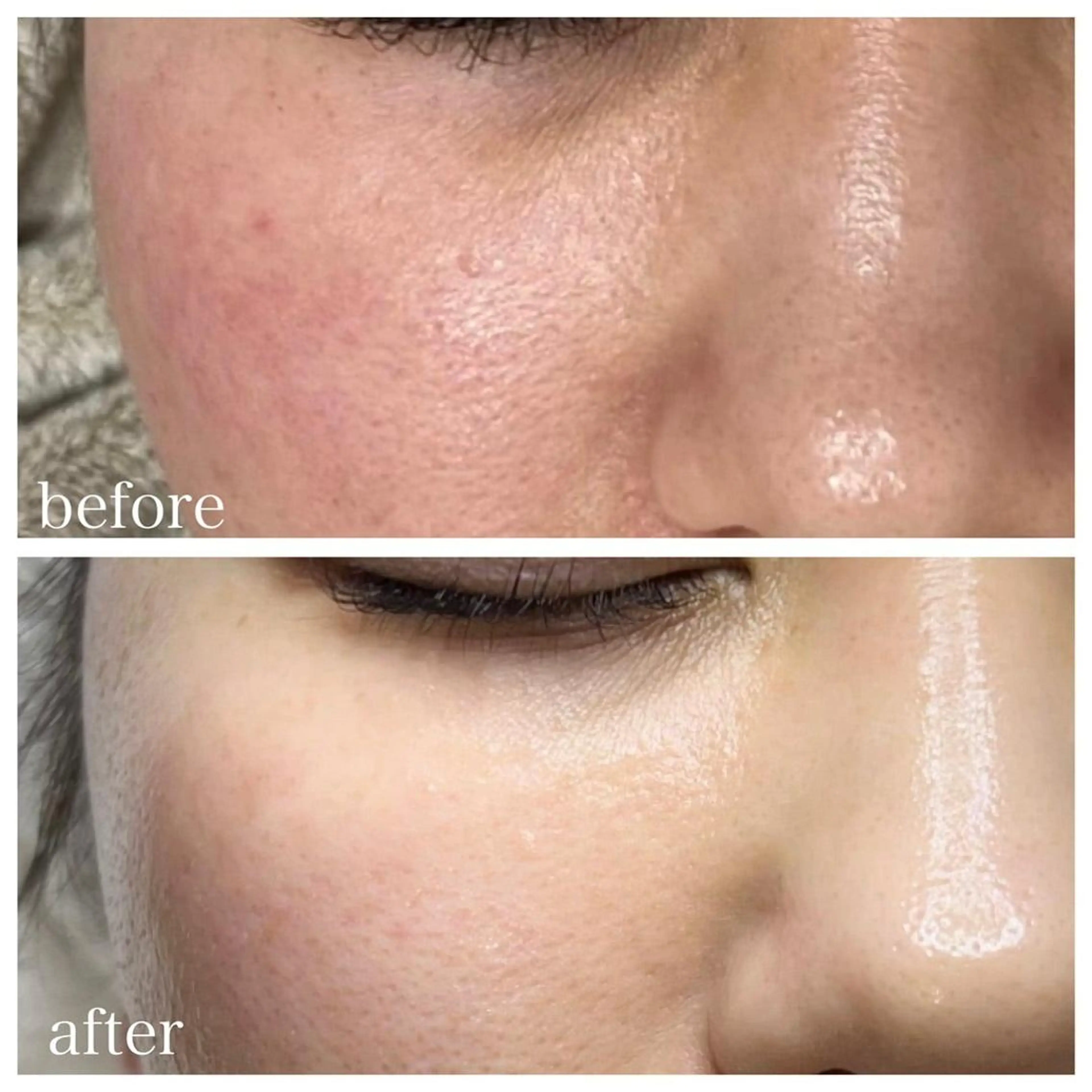 脱毛・眉毛・フェイス サロンN久留米店のその他イメージ