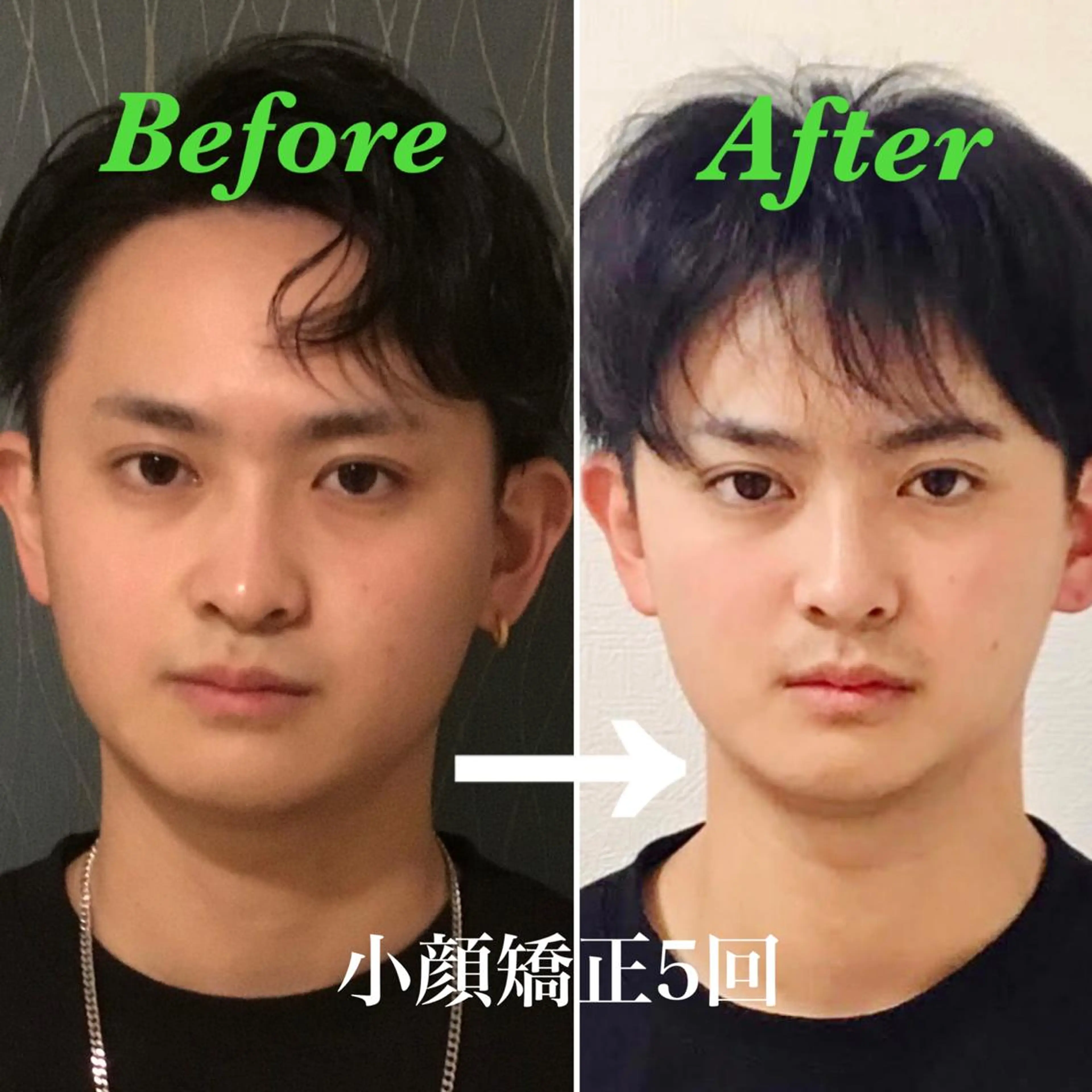 新規男性限定⭐️プロの専門技術✨モデルさん❗イベント前にも❗️小顔＋首肩＋頭蓋骨矯正（極上ヘッドマッサージ）60分の写真