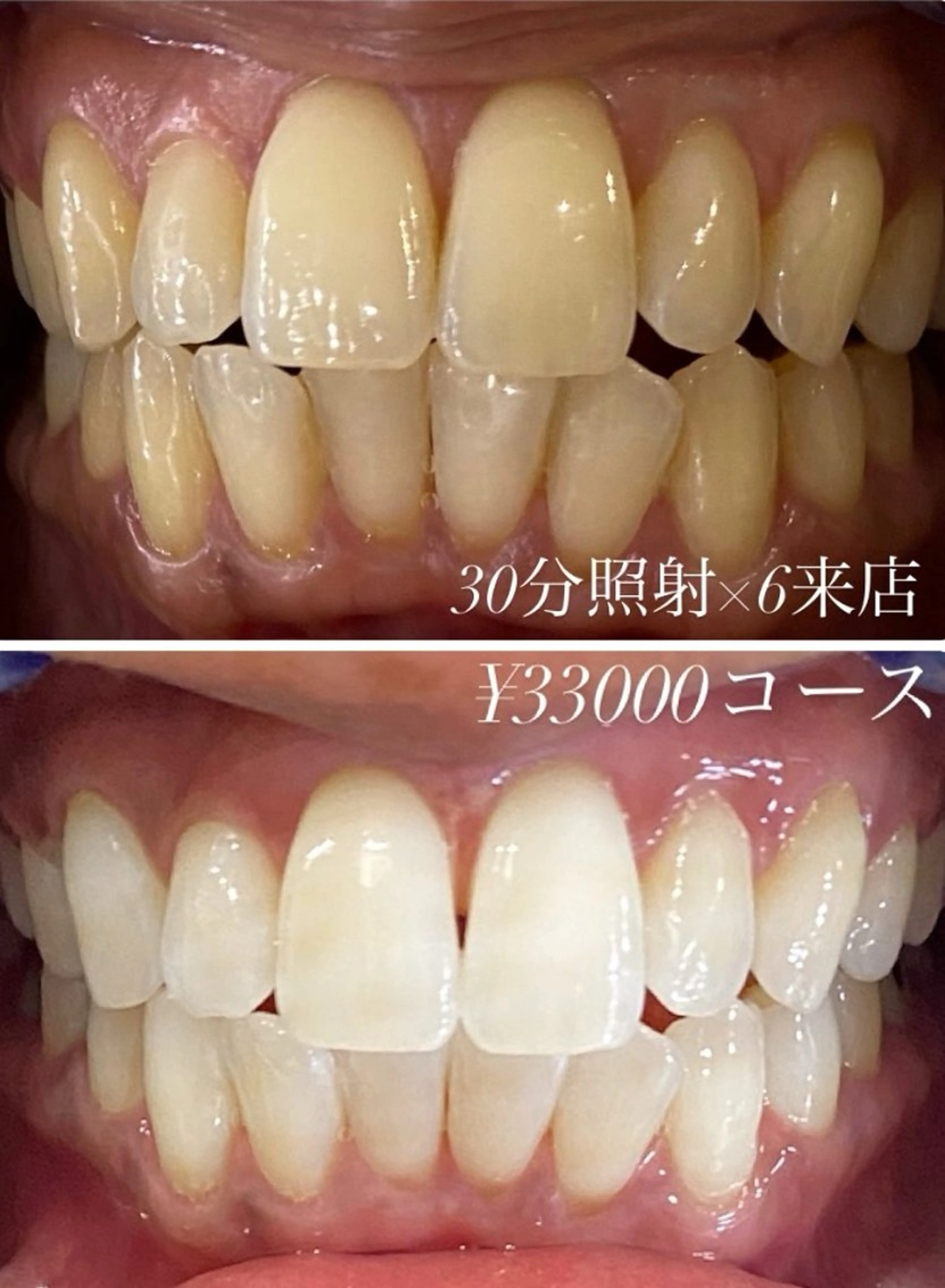 その他 ホワイトニングルーム 川崎店所属・ホワイトニング ルーム 川崎店のその他イメージ