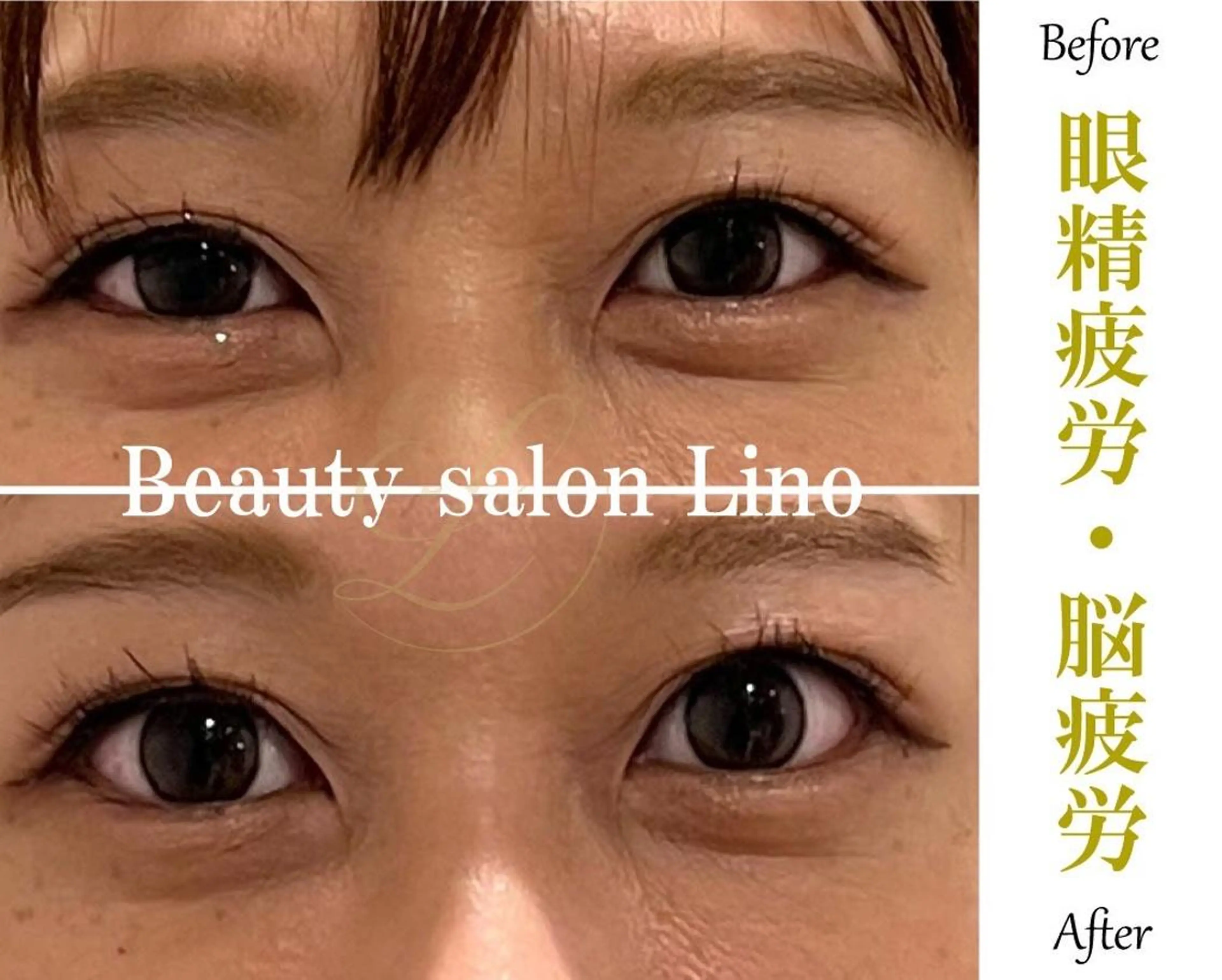 エステ リラク 痩身×フェイシャル ブライダル|Linoのエステ・リラクイメージ