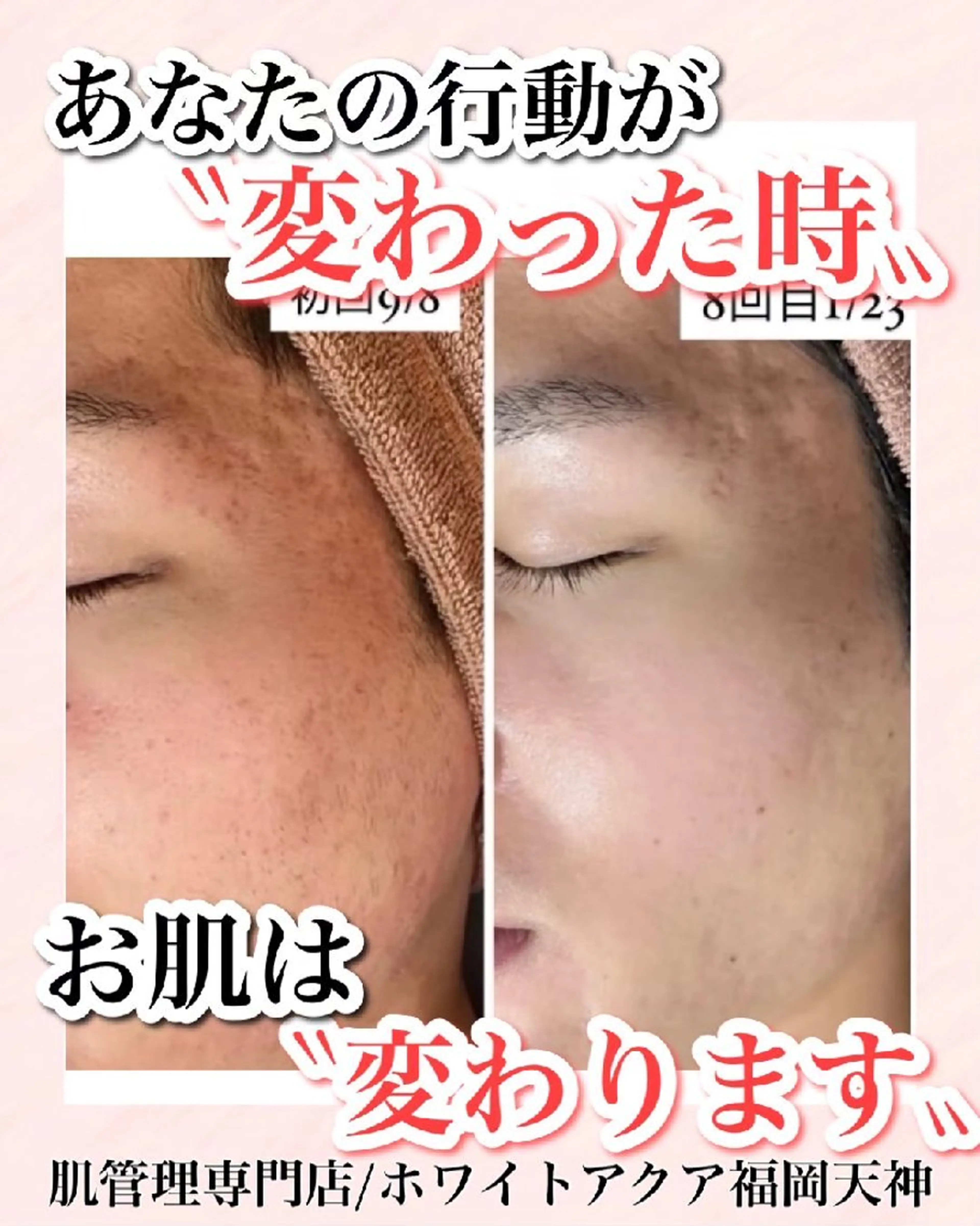 メンズ キッズ WHITEAQUA 福岡天神店のエステ・リラクイメージ